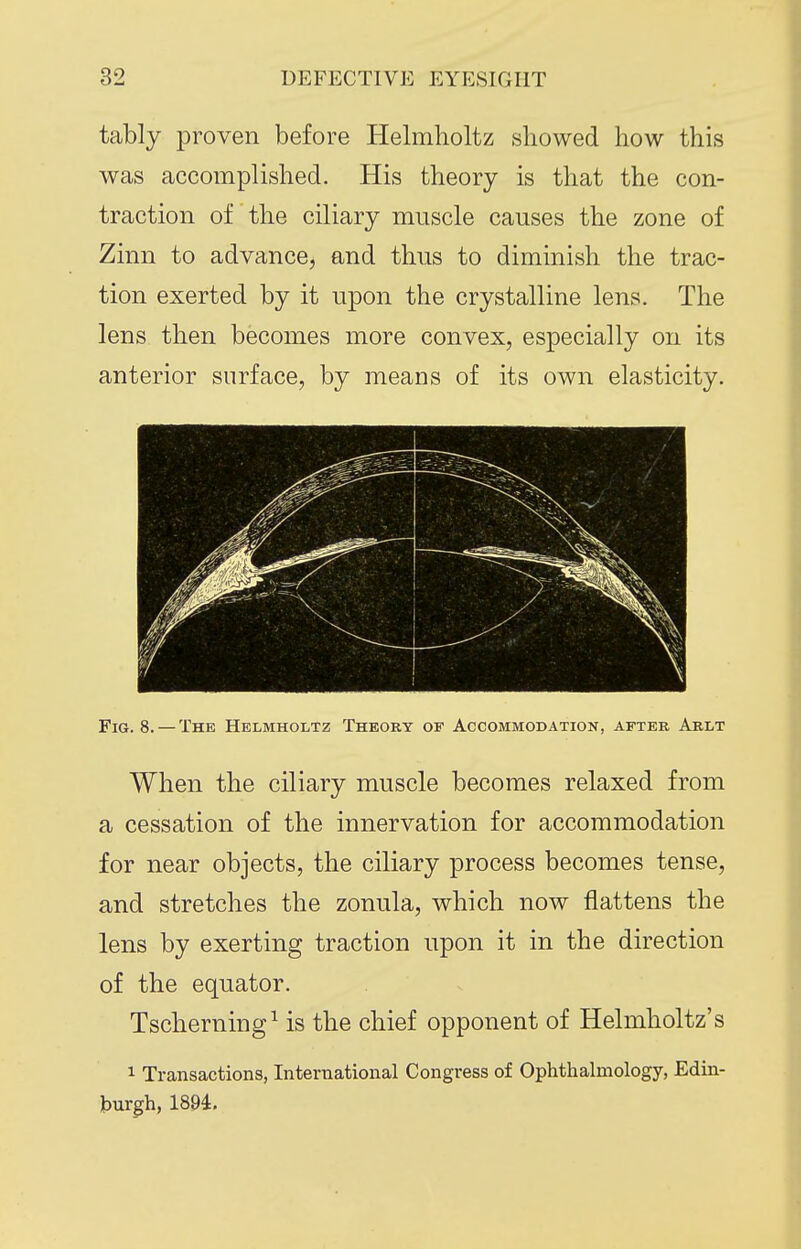 tably proven before Helmholtz showed how this was accomplished. His theory is that the con- traction of the ciliary muscle causes the zone of Zinn to advance, and thus to diminish the trac- tion exerted by it upon the crystalline lens. The lens then becomes more convex, especially on its anterior surface, by means of its own elasticity. Fig. 8. — The Helmholtz Theory of Accommodation, after Arlt When the ciliary muscle becomes relaxed from a cessation of the innervation for accommodation for near objects, the ciliary process becomes tense, and stretches the zonula, which now flattens the lens by exerting traction upon it in the direction of the equator. Tscherning^ is the chief opponent of Helmholtz's 1 Transactions, International Congress of Ophthalmology, Edin- burgh, 1894,