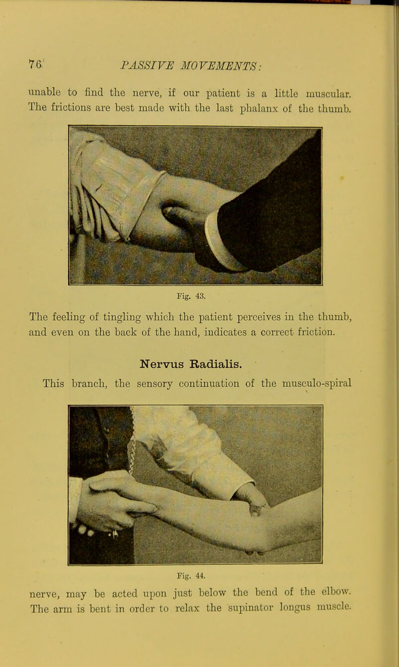 unable to find the nerve, if our patient is a little muscular. The frictions are best made with the last phalanx of the thumb. Fig. 43. The feeling of tingling which the patient perceives in the thumb, and even on the back of the hand, indicates a correct friction. Nervus Radialis. This branch, the sensory continuation of the musculo-spiral Fig. 44. nerve, may be acted upon just below the bend of the elbow. The arm is bent in order to relax the supinator longus muscle.