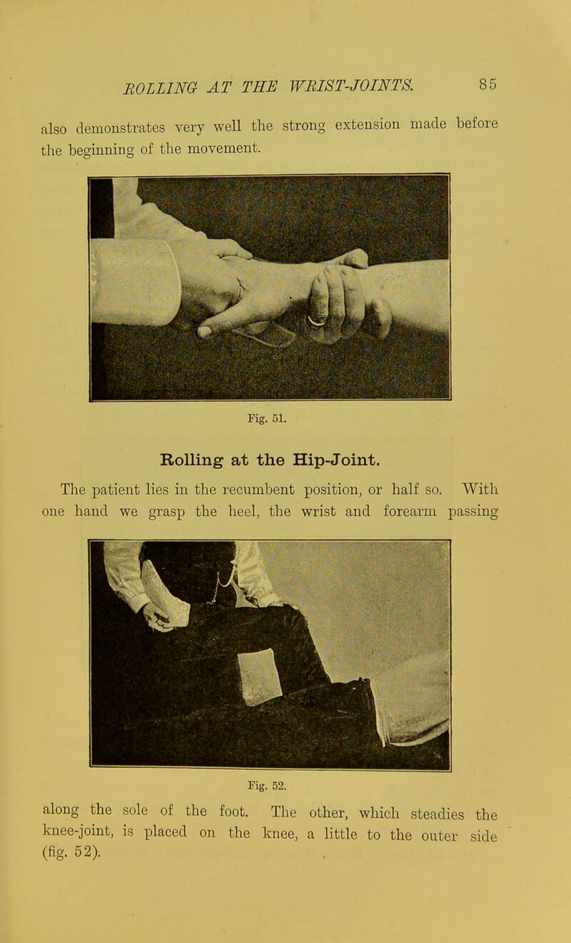 also demonstrates very well the strong extension made before the beginning of the movement. Fig. 51. Rolling at the Hip-Joint. The patient lies in the recumbent position, or half so. With one hand we grasp the heel, the wrist and forearm passing Fig. 52. along the sole of the foot. The other, which steadies the knee-joint, is placed on the knee, a little to the outer side (fig. 52).