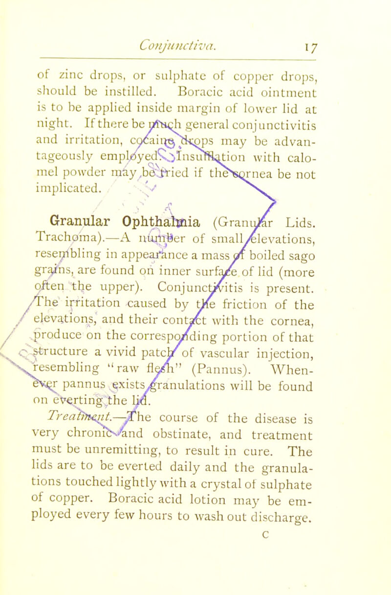 of zinc drops, or sulpliatc of copper drops, should be instilled. Boracic acid ointment is to be applied inside margin of lower lid at night. If there be ri^sqh general conjunctivitis and irritation, CQCaii^g^tk;pps may be advan- tageously empl^ed*x:>Insufi^tion with calo- mel powder miy_,bgj>ried if tlie>SQrnea be not implicated. .'.^y >v Granular Ophthaliaaia (Granibfer Lids. Trachoma).—A uiunber of small/felevations, resei?1bling in appea/ance a mass aft boiled sago grains, are found on inner surfa^fe of lid (more often the upper). Conjunctivitis is present. /The ip-itation caused by tj/k friction of the elevations,' and their contafct with the cornea, ..produce on the correspo/ding portion of that C-gtructure a vivid patcj/of vascular injection, S^esembhng raw fleidi (Pannus). When- evi^ pannus exists/ranulations will be found on everting'the 1^. Treahtqit.—^he course of the disease is very chronibs^nd obstinate, and treatment must be unremitting, to result in cure. The lids are to be everted daily and the granula- tions touched lightly with a crystal of sulphate of copper. Boracic acid lotion may be em- ployed every few hours to wash out discharo-e. c