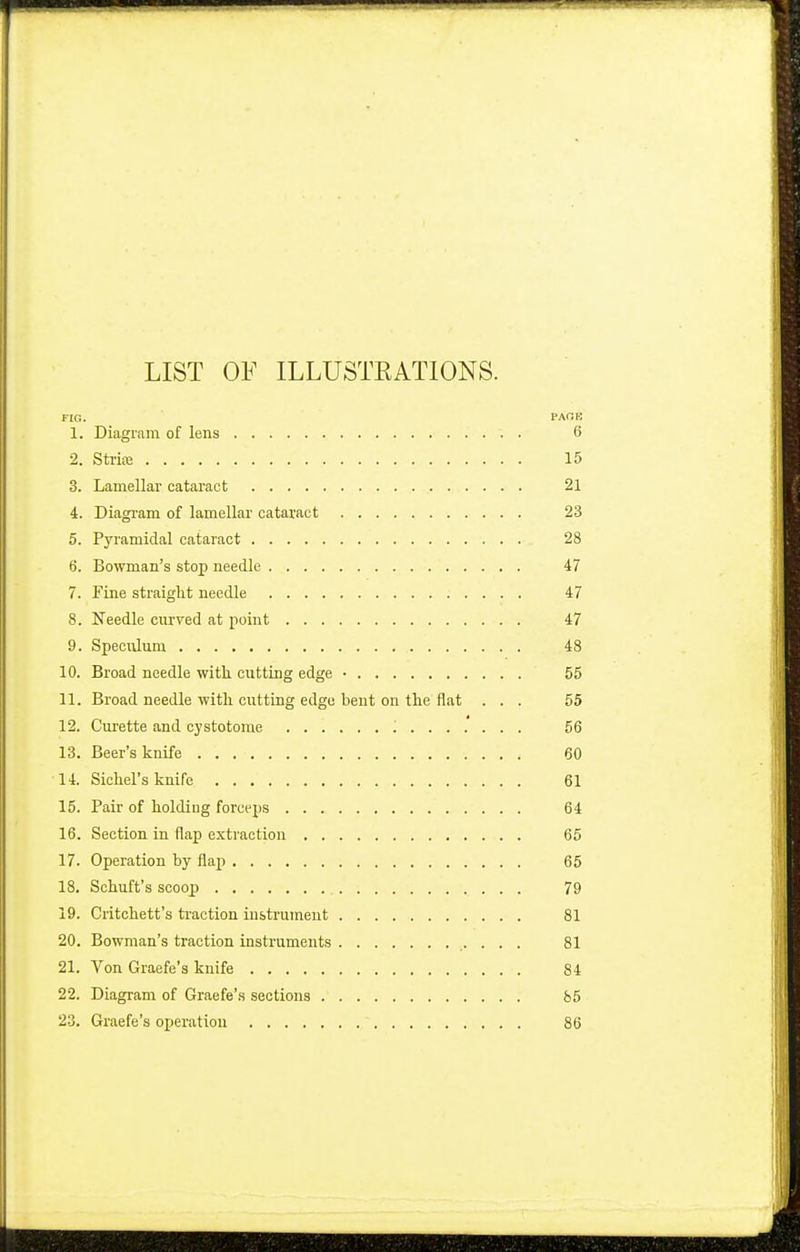 LIST OF ILLUSTKATIONS. FIG. PAOE 1. Diagram of lens 6 2. Stria: 15 3. Lamellar cataract 21 4. Diagram of lamellar cataract 23 5. Pyramidal cataract 28 6. Bowman's stop needle 47 7. Fine straight needle 47 8. Needle curved at point 47 9. Speculum. 48 10. Broad needle with cutting edge • 55 11. Broad needle with cutting edge bent on the flat ... 55 12. Curette and cystotomy '. 56 13. Beer's knife 60 14. Sichel's knife 61 15. Pair of holding forceps 64 16. Section in flap extraction 65 17. Operation by flap 65 18. Schuft's scoop 79 19. Critchett's traction instrument 81 20. Bowman's traction instruments 81 21. Von Graefe's knife 84 22. Diagram of Graefe's sections 85 23. Graefe's operation 86