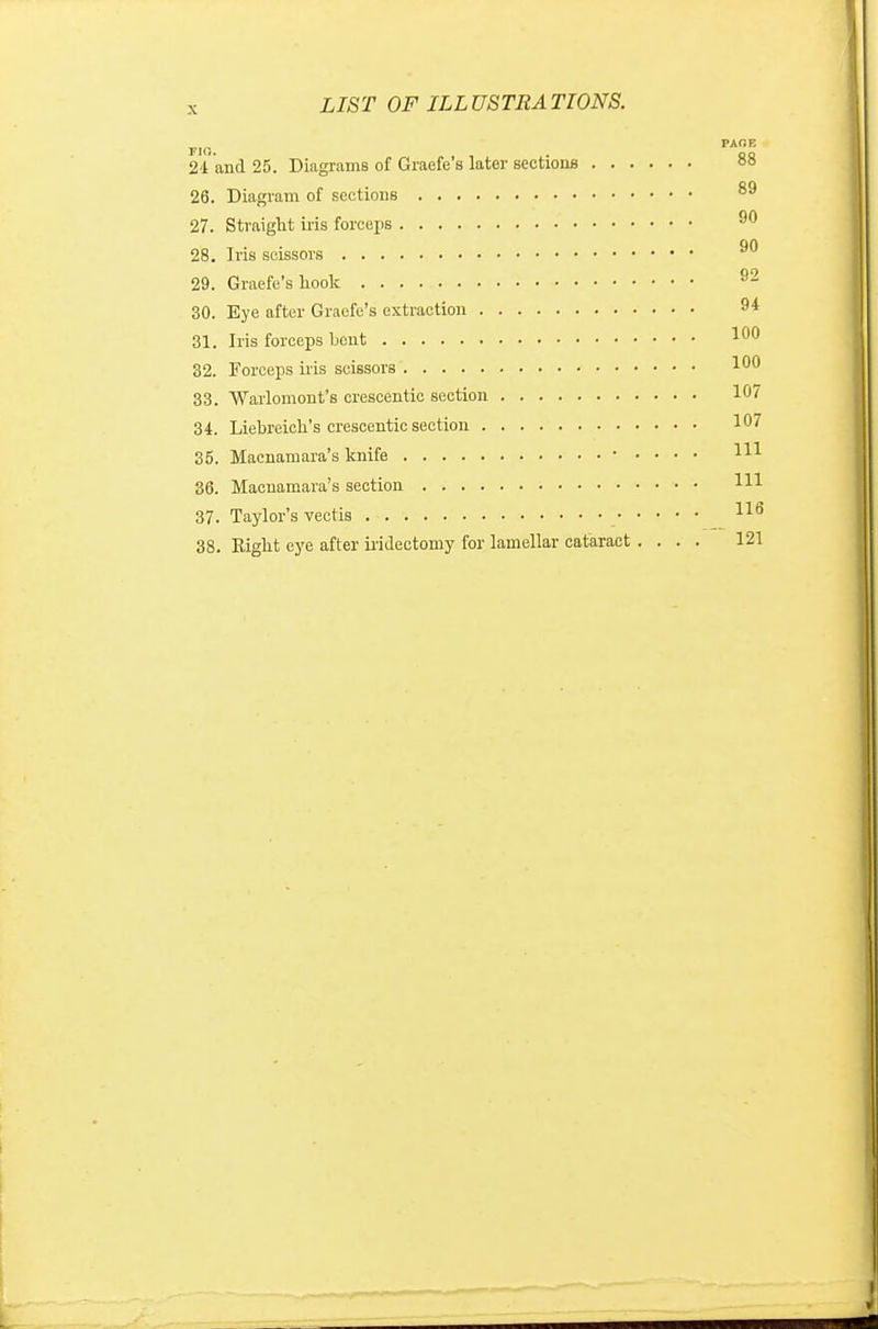 PAOE 21 and 25. Diagrams of Graefe s later sections °° 26. Diagram of sections 27. Straight iris forceps 90 on 28. Iris scissors 29. Graefe'shook 92 30. Eye after Graefe's extraction 94 31. Iris forceps bent 100 32. Forceps iris scissors 100 33. Warlomont's crescentic section 107 34. Liebreich's crescentic section 10? 35. Macnamara's knife Ill 36. Macnamara's section HI 37. Taylor's vectis 116 38. Eight eye after iridectomy for lamellar cataract .... 121