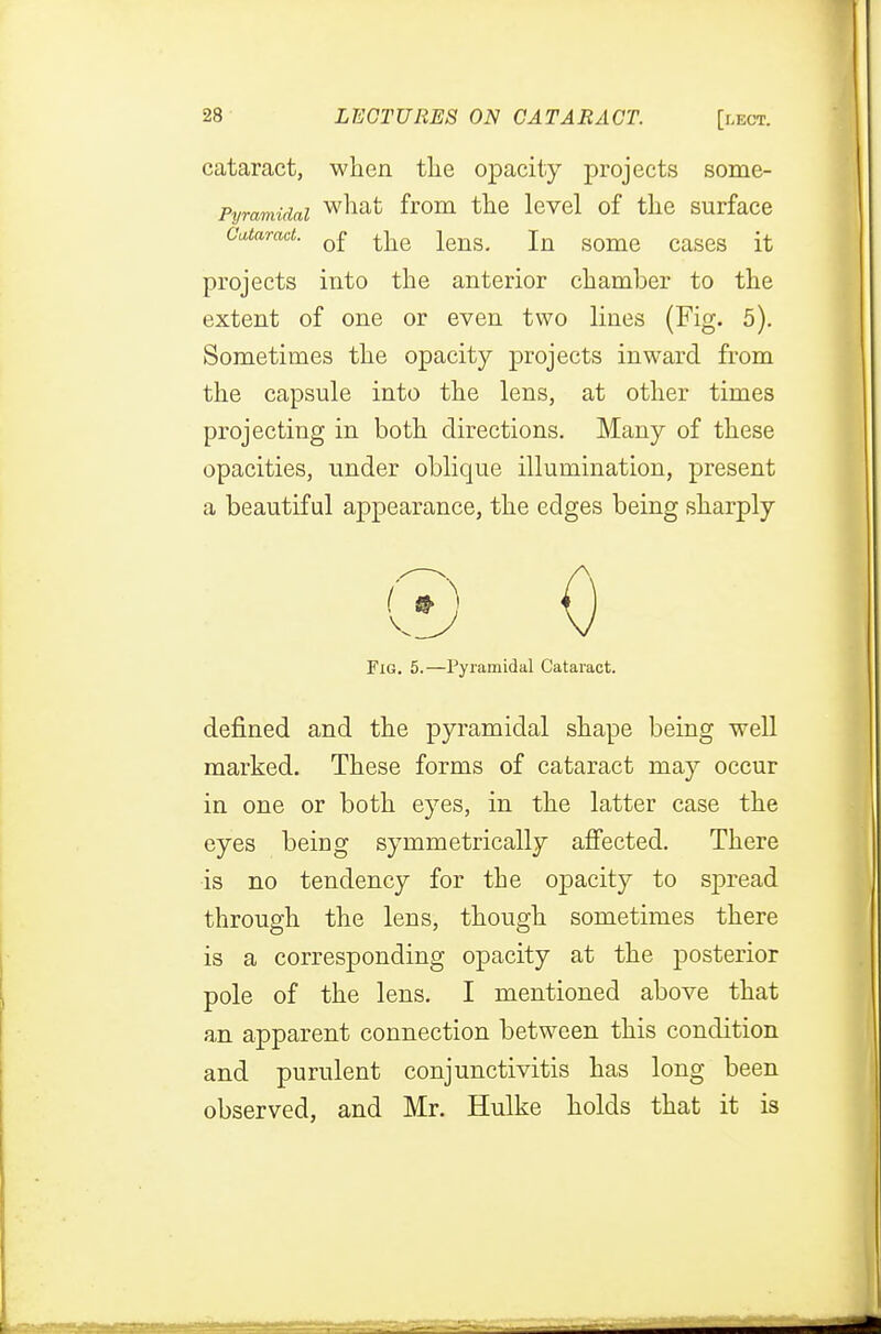 cataract, when the opacity projects some- Pymmidai wnat from the level of the surface Cataract. 0f t^Q lens. In some cases it projects into the anterior chamber to the extent of one or even two lines (Fig. 5). Sometimes the opacity projects inward from the capsule into the lens, at other times projecting in both directions. Many of these opacities, under oblique illumination, present a beautiful appearance, the edges being sharply © 0 Fig. 5.—Pyramidal Cataract. defined and the pyramidal shape being well marked. These forms of cataract may occur in one or both eyes, in the latter case the eyes being symmetrically affected. There is no tendency for the opacity to spread through the lens, though sometimes there is a corresponding opacity at the posterior pole of the lens. I mentioned above that an apparent connection between this condition and purulent conjunctivitis has long been observed, and Mr. Hulke holds that it is