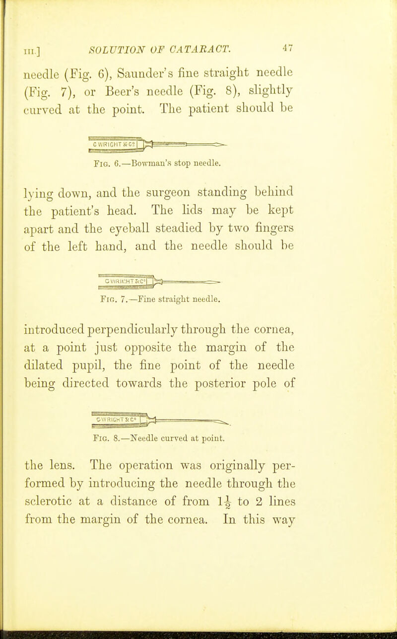 needle (Fig. 6), Saunder's fine straight needle (Fig. 7), or Beer's needle (Fig. 8), slightly- curved at the point. The patient should be ^ C WRIGHT 80S Fig. 6.—Bowman's stop needle. lvino- down, and the surgeon standing behind the patient's head. The lids may be kept apart and the eyeball steadied by two fingers of the left hand, and the needle should be Fir. 7.—Fine straight needle. introduced perpendicularly through the cornea, at a point just opposite the margin of the dilated pupil, the fine point of the needle being directed towards the posterior pole of Fig. 8.—Needle curved at point. the lens. The operation was originally per- formed by introducing the needle through the sclerotic at a distance of from 1-^ to 2 lines from the margin of the cornea. In this way