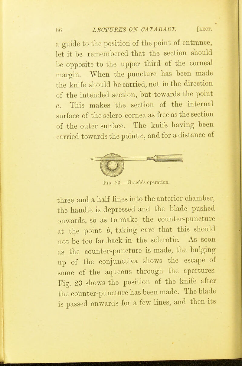 a guide to the position of the point of entrance, let it be remembered that the section should be opposite to the upper third of the corneal margin. When the puncture has been made the knife should be carried, not in the direction of the intended section, but towards the point c. This makes the section of the internal surface of the sclero-cornea as free as the section of the outer surface. The knife having been carried towards the point c, and for a distance of Fig. 23.—Graefe'a operation. three and a half lines into the anterior chamber, the handle is depressed and the blade pushed onwards, so as to make the counter-puncture at the point b, taking care that this should not be too far back in the sclerotic. As soon as the counter-puncture is made, the bulging up of the conjunctiva shows the escape of some of the aqueous through the apertures. Fig. 23 shows the position of the knife after the counter-puncture has been made. The blade is passed onwards for a few lines, and then its