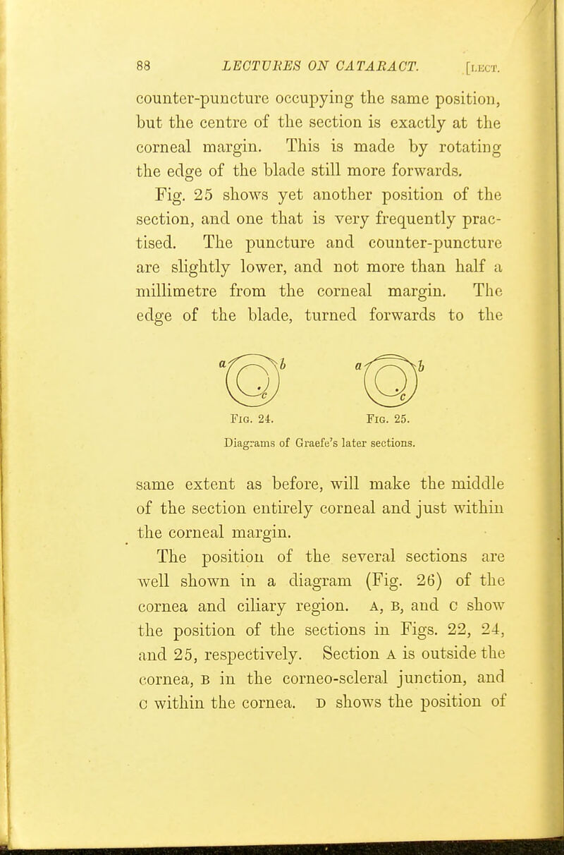 counter-puncture occupying the same position, but the centre of the section is exactly at the corneal margin. This is made by rotating the edge of the blade still more forwards. Fig. 25 shows yet another position of the section, and one that is very frequently prac- tised. The puncture and counter-puncture are slightly lower, and not more than half a millimetre from the corneal margin. The edge of the blade, turned forwards to the Fig. 24. Fig. 25. Diagrams of Graefe's later sections. same extent as before, will make the middle of the section entirely corneal and just within the corneal margin. The position of the several sections are well shown in a diagram (Fig. 26) of the cornea and ciliary region, a, b, and c show the position of the sections in Figs. 22, 24, and 25, respectively. Section a is outside the cornea, b in the corneo-scleral junction, and c within the cornea, d shows the position of