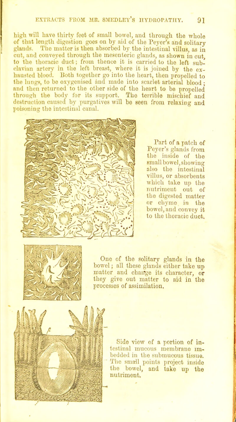 high will have thirty feet of small bowel, and through the whole of that length digestion goes on by aid of the Peyer's and solitary glands. The matter is then absorbed by the intestinal villus, as in cut, and conveyed through the mesenteric glands, as shown in cut to the thoracic duct; from thence it is carried to the left sub- clavian artery in the left breast, where it is joined by the ex- hausted blood. Both together go into the heart, then propelled to the lungs, to be oxygenised and made into scarlet arterial blood • and then returned to the other side of the heart to be propelled through the body for its support. The terrible mischief and destruction caused by purgatives will be seen from relaxing and poisoning the intestinal canal. Part of a patch of Peyer's glands from the inside of the small bowel, showing also the intestinal villus, or absorbents which take up the nutriment out of the digested matter or cbyme in the bowel, and convey it to the thoracic duct. One of the solitary glands in the bowel; all these glands either take up matter and change its character, or they give out matter to aid in the processes of assimilation. Side view of a portion of in- testinal mucous membrane im- bedded in the submucous tissue. The sma-11 points project inside the bowel, and take up the nutriment.