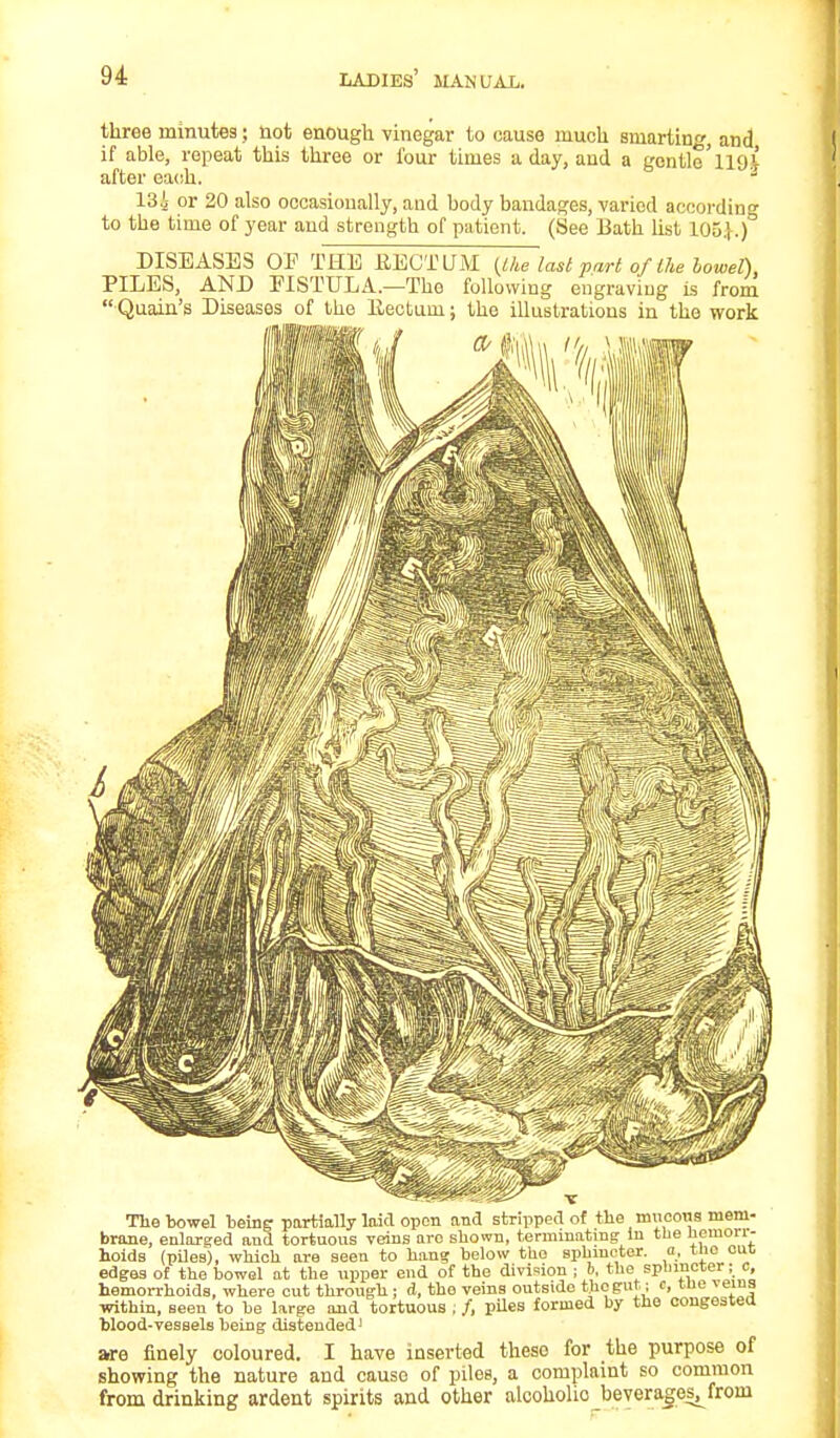 three minutes; not enough vinegar to cause much smarting and if able, repeat this three or four times a day, and a gentle'llO.V after each. 1 13i or 20 also occasionally, and body bandages, varied according to the time of year and strength of patient. (See Bath list LOB}.) DISEASES OF THE HECTUM (the last part of the bowel), PILES, AND FISTULA.—The following engraving is from  Quain's Diseases of the llectum; the illustrations in the work The bowel being partially laid open and stripped of the mucous mem- brane, enlarged and tortuous veins arc shown, terminating In the neuiorr- hoids (piles), which are seen to hang below the sphincter, a. tiie cue edges of the bowel at the upper end of the division ; b, the sphincter; c, hemorrhoids, where cut through; d, the veins outside the gut; c, tne veins within, seen to be large and tortuous , /, piles formed by the congested blood-vessels being distended' are finely coloured. I have inserted these for the purpose of showing the nature and cause of piles, a complaint so common from drinking ardent spirits and other alcoholic beverages^from