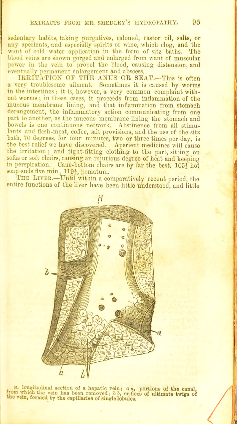 sedentary habits, taking purgatives, calomel, castor oil, salts, or any aperients, and especially spirits of wine, which clog, and the want of cold water application in the form of sitz baths. The blood veins aro shown gorged and enlarged from want of muscular power in the vein to propel the blood, causing distension, and eventually permanent enlargement and abscess. HABITATION OF THE ANUS OR SEAT.—This is often a very troublesome ailment. Sometimes it is caused by worms in the intestines ; it is, however, a very common complaint with- out worms; in these cases, it proceeds from inflammation of the mucous membrane lining, and that inflammation from stomach derangement, the inflammatory action communicating from one part to another, as the mucous membrane lining the stomach and bowels is one continuous network. Abstinence from all stimu- lants and flesh-meat, coffee, salt provisions, and the use of the sitz bath, 70 degrees, for four minutes, two or three times per day, is the best relief we have discovered. Aperient medicines will cause the irritation; and tight-fitting clothing to the part, sitting on sofas or soft chairs, causing an injurious degree of heat and keeping in perspiration. Cane-bottom chairs are by far the best. 105* hot soap-suds five min., 1191, pomatum. The Liter.—Until within a comparatively recent period, the entire functions of the liver have been little understood, and little f, longitudinal section of a hepatic vein; a a, portions of the canal, n which the vein has boon removed; b b, orifices of ultimate twigs of vein, formed by the capillaries of single lobules. H