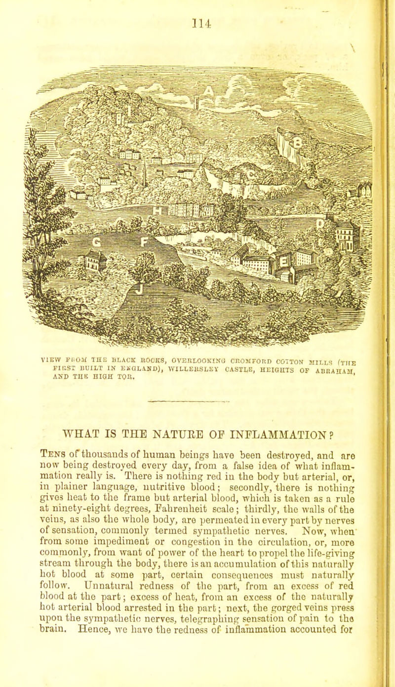 VIEW FI.OM THE BLACK HOCKS, OVEItLOOKINJ CltOMFOltD COTTON MILLS fTl «BSI BUILT IH EKGLAHD), WILLEBSLEY CASTLE, HEIGHTS OF ABItAHA AND THIS HIGH TOR. WHAT IS THE NATURE OP INFLAMMATION ? Tens of thousands of human beings have been destroyed, and are now being destroyed every day, from a false idea of what inflam- mation really is. There is nothing red in the body but arterial, or, in plainer language, nutritive blood; secondly, there is nothing gives heat to the frame but arterial blood, which is taken as a rule at ninety-eight degrees, Fahrenheit scale; thirdly, the walls of the veins, as also the whole body, are permeated in every part by nerves of sensation, commonly termed sympathetic nerves. Now, when from some impediment or congestion in the circulation, or, more commonly, from want of power of the heart to propel the life-giving stream through the body, there is an accumulation of this naturally hot blood at some part, certain consequences must naturally follow. Unnatural redness of the part, from an excess of red blood at the part; excess of heat, from an excess of the naturally hot arterial blood arrested in the part; next, the gorged veins press upon the sympathetic nerves, telegraphing sensation of pain to thtt brain. Hence, we have the redness of inflammation accounted for