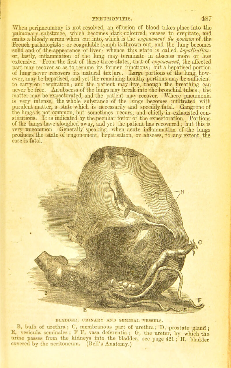 When peripneumony is not resolved, an effusion of blood takes place into the pulmonary substance, -which becomes dark-coloured, ceases to crepitate, and emits a bloody scrum when cut into, which is the engouement du poumon of the French pathologists: or coagulable lymph is thrown out, and the lung becomes solid and of the appearance of liver; whence this state is called hepatisation .- or, lastly, inflammation of the lung may terminate in abscess more or less extensive. From the first of these three states, that of engouement, the affected part may recover so as to resume its former functions; but a hepatised portion of lung never recovers its natural texture. Large portions of the lung, how- ever, maybe hepatised, and yet the remaining healthy portions may be sufficient to cany on respiration; and the patient may live, though the breathing can uever be free. An abscess of the lungs may break into the bronchial tubes; the inatter may be expectorated, and the patient may Tecover. Where pneumonia is very intense, the whole substance of the lungs becomes infiltrated with purulent matter, a state which is necessarily and speedily fatal. Gangrene of the lungs is not common, but sometimes occurs, and chiefly in exhausted con- stitutions. It is indicated by the peculiar fcetor of the expectoration. Portions of the bangs have sloughed away, and yet the patient has recovered; but this is very uncommon. Generally' speaking, when acute inflammation of the lungs produces the state of engouement, hepatisation, or abscess, to any extent, the case is fatal. B8AD9BB, DKBM&T AND SEMINAL VESSELS. B, bulb of urethra ; C, membranous part of urethra; D, prostate gland; E, yesicula seminales ; !•' P, vasa defer entia ; G, the ureter, bv which the urine passes from the kidneys into the bladder, see page 421 ; H, bladder covered by the oeritoneum. (Bell's Anatomy.)