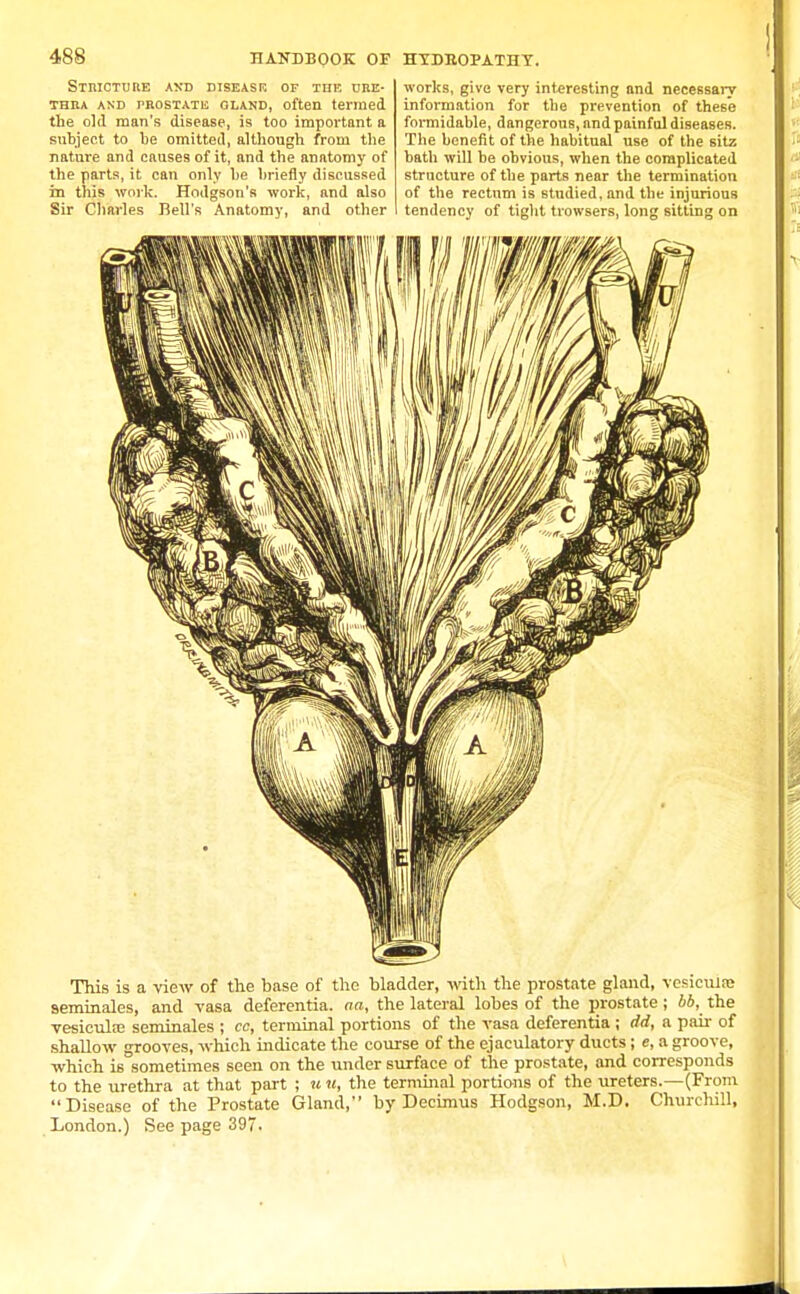 Stricture axd disease of tiie ure- thra and prostata GLAND, often termed the old man's disease, is too important a subject to be omitted, although from the nature and causes of it, and the anatomy of the parts, it can only be briefly discussed m this work. Hodgson's work, and also Sir Charles Bell's Anatomy, and other works, give very interesting and necessary information for the prevention of these formidable, dangerous, and painful diseases. The benefit of the habitual use of the sitz bath will be obvious, when the complicated structure of the parts near the termination of the rectum is studied, and the injurious tendency of tight trowsers, long sitting on This is a view of the base of the bladder, with the prostate gland, vesiemne 9eminales, and vasa deferentia. aa, the lateral lobes of the prostate; 66, the vesicular seminales ; cc, terminal portions of the vasa deferentia; dd, a pair of shallow grooves, which indicate the course of the ejaculatory ducts; e, a groove, which is sometimes seen on the under surface of the prostate, and corresponds to the urethra at that part ; u u, the terminal portions of the ureters.—(From Disease of the Prostate Gland, by Derimus Hodgson, M.D. Churchill, London.) See page 397.