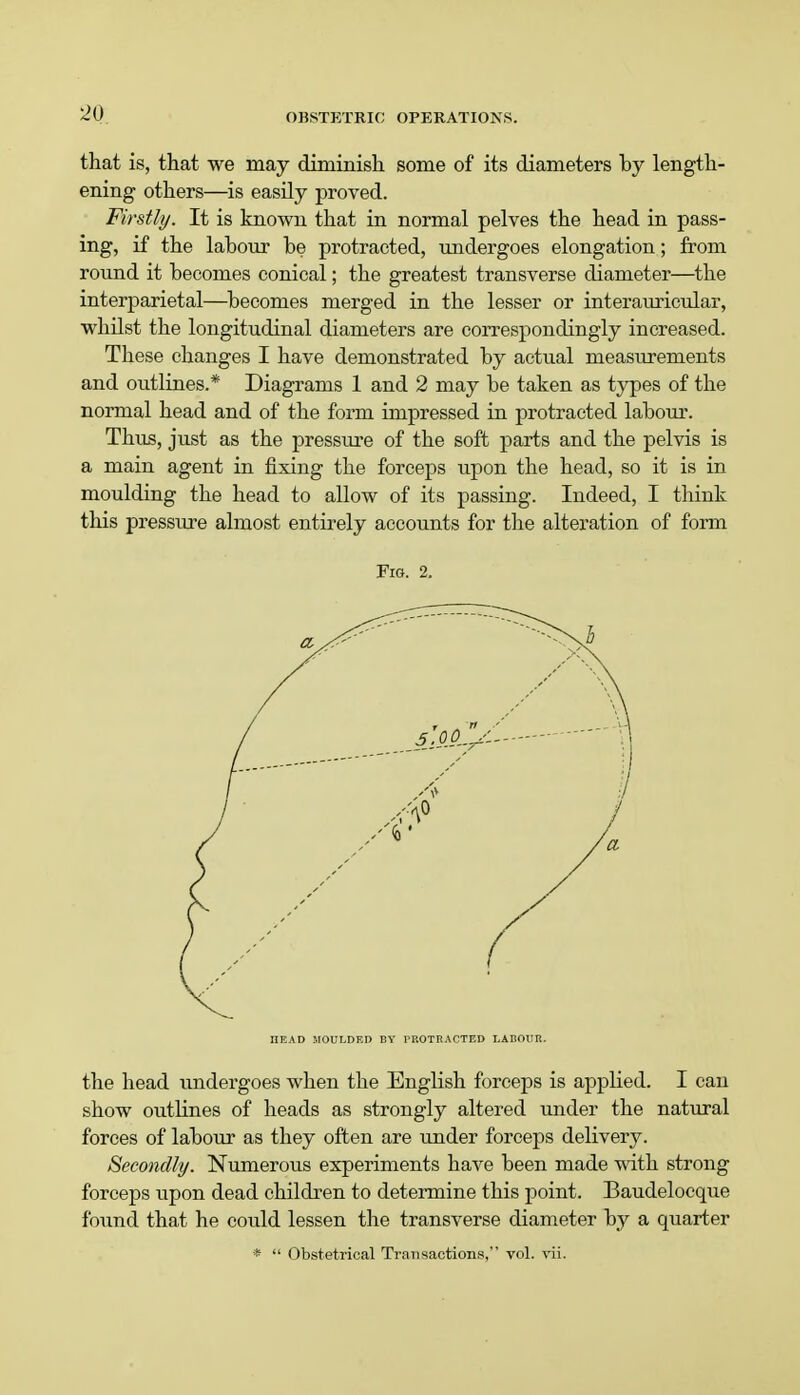 that is, that we may diminish some of its diameters by length- ening others—is easily proved. Firstly. It is known that in normal pelves the head in pass- ing, if the labour be protracted, undergoes elongation; from round it becomes conical; the greatest transverse diameter—the interparietal—becomes merged in the lesser or interauricular, whilst the longitudinal diameters are correspondingly increased. These changes I have demonstrated by actual measurements and outlines.* Diagrams 1 and 2 may be taken as types of the normal head and of the form impressed in protracted labour. Thus, just as the pressure of the soft parts and the pelvis is a main agent in fixing the forceps upon the head, so it is in moulding the head to allow of its passing. Indeed, I think this pressure almost entirely accounts for the alteration of form Fig. 2. HEAD MOULDED BY PROTRACTED LABOUR. the head undergoes when the English forceps is applied. I can show outlines of heads as strongly altered under the natural forces of labour as they often are under forceps delivery. Secondly. Numerous experiments have been made with strong forceps upon dead children to determine this point. Baudelocque found that he could lessen the transverse diameter by a quarter * Obstetrical Transactions, vol. vii.