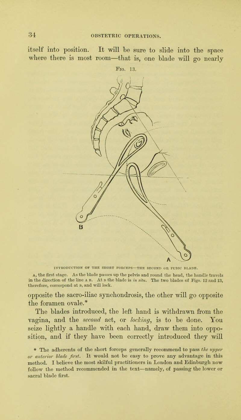 itself into position. It will be sure to slide into the space where there is most room—that is, one blade will go nearly Fig. 13. INTRODUCTION OF THE SHORT FORC EPS—THE SECOND OB PUBIC BLADE. A, the first stage. As the blade passes up the pelvis and round the head, the handle travels in the direction of the line a b. At b the blade is in situ. The two blades of Figs. 12 and 13, therefore, correspond at b, and will lock. opposite the sacro-iliac synchondrosis, the other will go opposite the foramen ovale.* The blades introduced, the left hand is withdrawn from the vagina, and the second act, or locking, is to be done. You seize lightly a handle with each hand, draw them into oppo- sition, and if they have been correctly introduced they will * The adherents of the short forceps generally recommend to pass the upper or anterior blade first. It would not be easy to prove any advantage in this method. I believe the most skilful practitioners in London and Edinburgh now follow the method recommended in the text—namely, of passing the lower or sacral blade first.