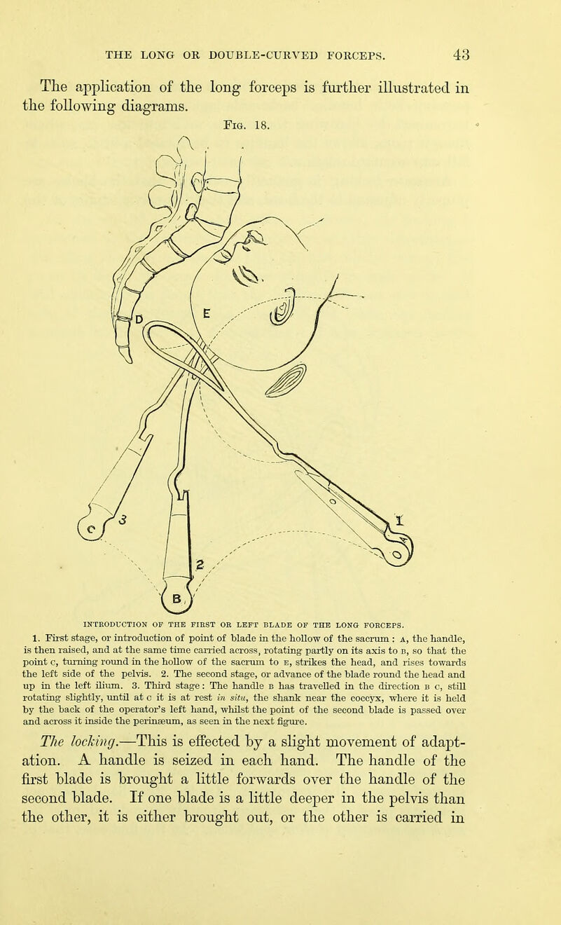 The application of the long forceps is further illustrated in the following diagrams. Fig. 18. INTRODUCTION OF THE FIRST OR LEFT BLADE OF THE LONG FORCEPS. 1. First stage, or introduction of point of blade in the hollow of the sacrum : a, the handle, is then raised, and at the same time carried across, rotating partly on its axis to b, so that the point c, turning round in the hollow of the sacrum to e, strikes the head, and rises towards the left side of the pelvis. 2. The second stage, or advance of the blade round the head and up in the left ilium. 3. Third stage: The handle b has travelled in the direction b c, still rotating slightly, until at c it is at rest in situ, the shank near the coccyx, where it is held by the back of the operator's left hand, whilst the point of the second blade is passed over and across it inside the perinaeum, as seen in the next figure. The locking.—This is effected by a slight movement of adapt- ation. A handle is seized in each hand. The handle of the first blade is brought a little forwards over the handle of the second blade. If one blade is a little deeper in the pelvis than the other, it is either brought out, or the other is carried in