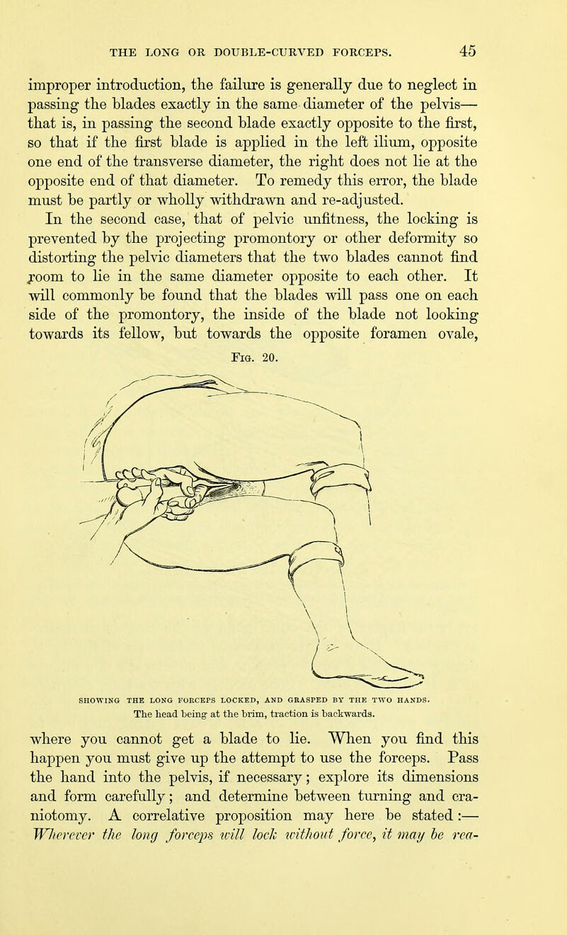 improper introduction, the failure is generally due to neglect in passing the blades exactly in the same diameter of the pelvis— that is, in passing the second blade exactly opposite to the first, so that if the first blade is applied in the left ilium, opposite one end of the transverse diameter, the right does not lie at the opposite end of that diameter. To remedy this error, the blade must be partly or wholly withdrawn and re-adjusted. In the second case, that of pelvic unfitness, the locking is prevented by the projecting promontory or other deformity so distorting the pelvic diameters that the two blades cannot find room to lie in the same diameter opposite to each other. It will commonly be found that the blades will pass one on each side of the promontory, the inside of the blade not looking towards its fellow, but towards the opposite foramen ovale, Fig. 20. SnOWING THE LONG FORCEPS LOCKED, AND GRASPED BY THE TWO HANDS. The head being at the brim, traction is backwards. where you cannot get a blade to lie. When you find this happen you must give up the attempt to use the forceps. Pass the hand into the pelvis, if necessary; explore its dimensions and form carefully; and determine between turning and cra- niotomy. A correlative proposition may here be stated:— Wherever the long forceps will lock without force, it ma// be rca-