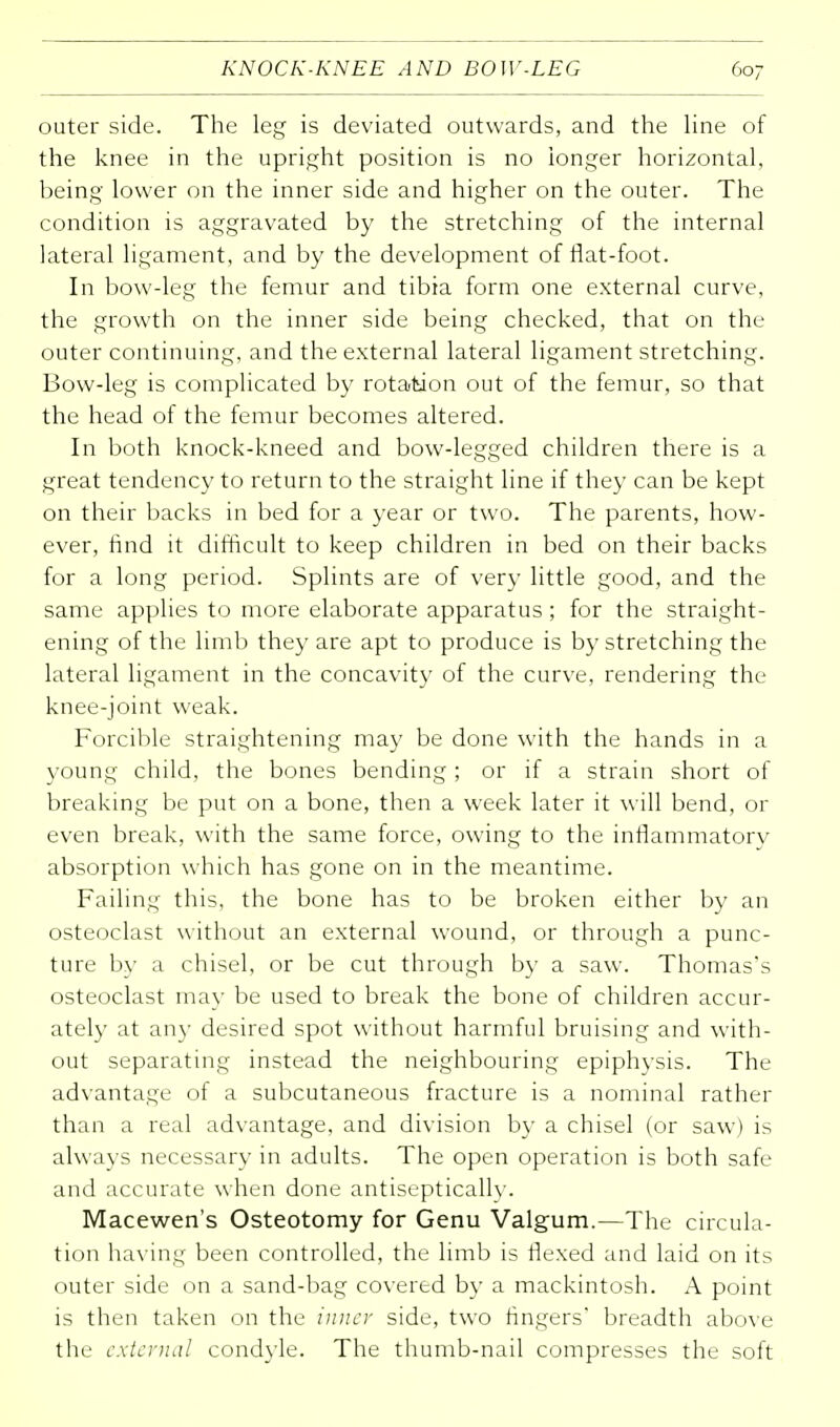 outer side. The leg is deviated outwards, and the line of the knee in the upright position is no longer horizontal, being lower on the inner side and higher on the outer. The condition is aggravated by the stretching of the internal lateral ligament, and by the development of flat-foot. In bow-leg the femur and tibia form one external curve, the growth on the inner side being checked, that on the outer continuing, and the external lateral ligament stretching. Bow-leg is complicated by rotation out of the femur, so that the head of the femur becomes altered. In both knock-kneed and bow-legged children there is a great tendency to return to the straight line if they can be kept on their backs in bed for a year or two. The parents, how- ever, find it difficult to keep children in bed on their backs for a long period. Splints are of very little good, and the same applies to more elaborate apparatus ; for the straight- ening of the limb they are apt to produce is by stretching the lateral ligament in the concavity of the curve, rendering the knee-joint weak. Forcible straightening may be done with the hands in a young child, the bones bending ; or if a strain short of breaking be put on a bone, then a week later it will bend, or even break, with the same force, owing to the inflammatory absorption which has gone on in the meantime. Failing this, the bone has to be broken either by an osteoclast without an external wound, or through a punc- ture by a chisel, or be cut through by a saw. Thomas's osteoclast may be used to break the bone of children accur- ately at any desired spot without harmful bruising and with- out separating instead the neighbouring epiphysis. The advantage of a subcutaneous fracture is a nominal rather than a real advantage, and division by a chisel (or saw) is always necessary in adults. The open operation is both safe and accurate when done antiseptically. Macewen's Osteotomy for Genu Valgum.—The circula- tion having been controlled, the limb is flexed and laid on its outer side on a sand-bag covered by a mackintosh. A point is then taken on the inner side, two fingers' breadth above the external condyle. The thumb-nail compresses the soft