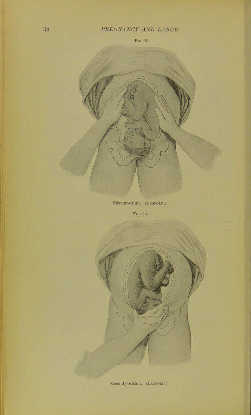 Fig. 13. First position. (Leopold.) Fig. 14. V. I, Second position. (Leopold.)