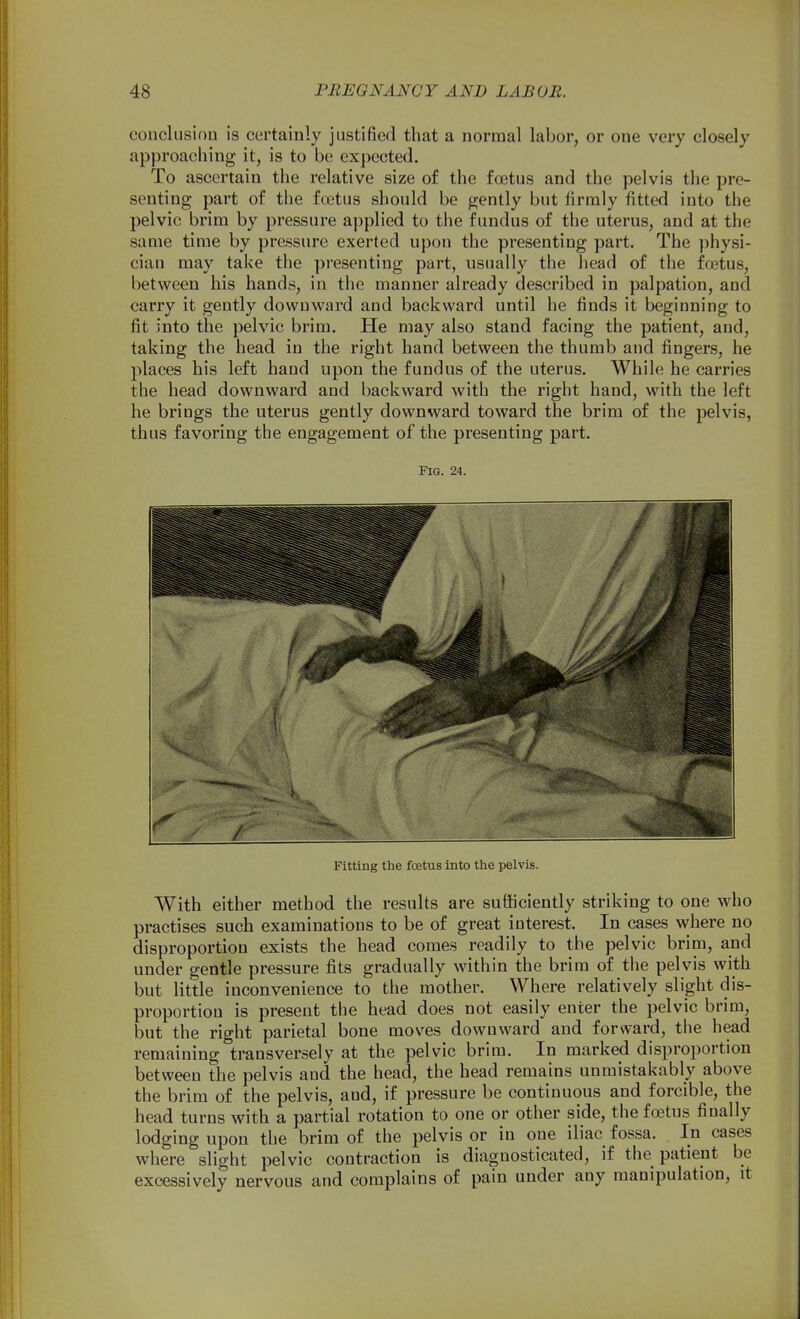 couclusiou is certainly justified that a normal labor, or one very closely approaching it, is to be expected. To ascertain the relative size of the foetus and the pelvis the pre- senting part of the foetus should be gently but firmly fitted into the pelvic brim by pressure applied to the fundus of the uterus, and at the same time by pressure exerted upon the presenting part. The physi- cian may take the presenting part, usually the head of the foetus, between his hands, in the manner already described in palpation, and carry it gently downward and backward until he finds it beginning to fit into the pelvic brim. He may also stand facing the patient, and, taking the head in the right hand between the thumb and fingers, he places his left hand upon the fundus of the uterus. While he carries the head downward and backward with the right hand, with the left he brings the uterus gently downward toward the brim of the pelvis, thus favoring the engagement of the presenting part. Fig. 24. Fitting the foetus into the pelvis. With either method the results are sufficiently striking to one who practises such examinations to be of great interest. In cases where no disproportion exists the head comes readily to the pelvic brim, and under gentle pressure fits gradually within the brim of the pelvis with but little inconvenience to the mother. Where relatively slight dis- proportion is present the head does not easily enter the pelvic brim, but the right parietal bone moves downward and forward, the head remaining transversely at the pelvic brim. In marked disproportion between the pelvis and the head, the head remains unmistakably above the brim of the pelvis, and, if pressure be continuous and forcible, the head turns with a partial rotation to one or other side, the foetus finally lodging upon the brim of the pelvis or in one iliac fossa. In cases where slight pelvic contraction is diagnosticated, if the patient be excessively nervous and complains of pain under any manipulation, it