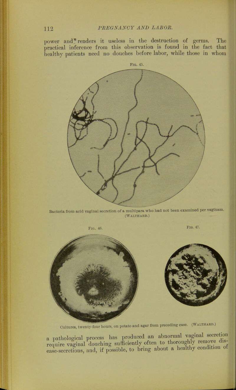 power and* renders it useless in the destruction of germs. The practical inference from this observation is found in the fact that healtliy patients need no douches before labor, while those in whom Fig. 45. Bacteria from acid vaginal secretion of a multipara who had not heen examined per vagiuam. (Walthard.) Fig. 46. Fig. 47. Cultures, twenty-four hours, on potato and agar from preceding case. (Walthakd.) a pathological process has produced an abnormal vagmal secretion require vaginal douching sufficiently often to thoroughly remove dis- ease-secretions, and, if possible, to bring about a healthy condition of