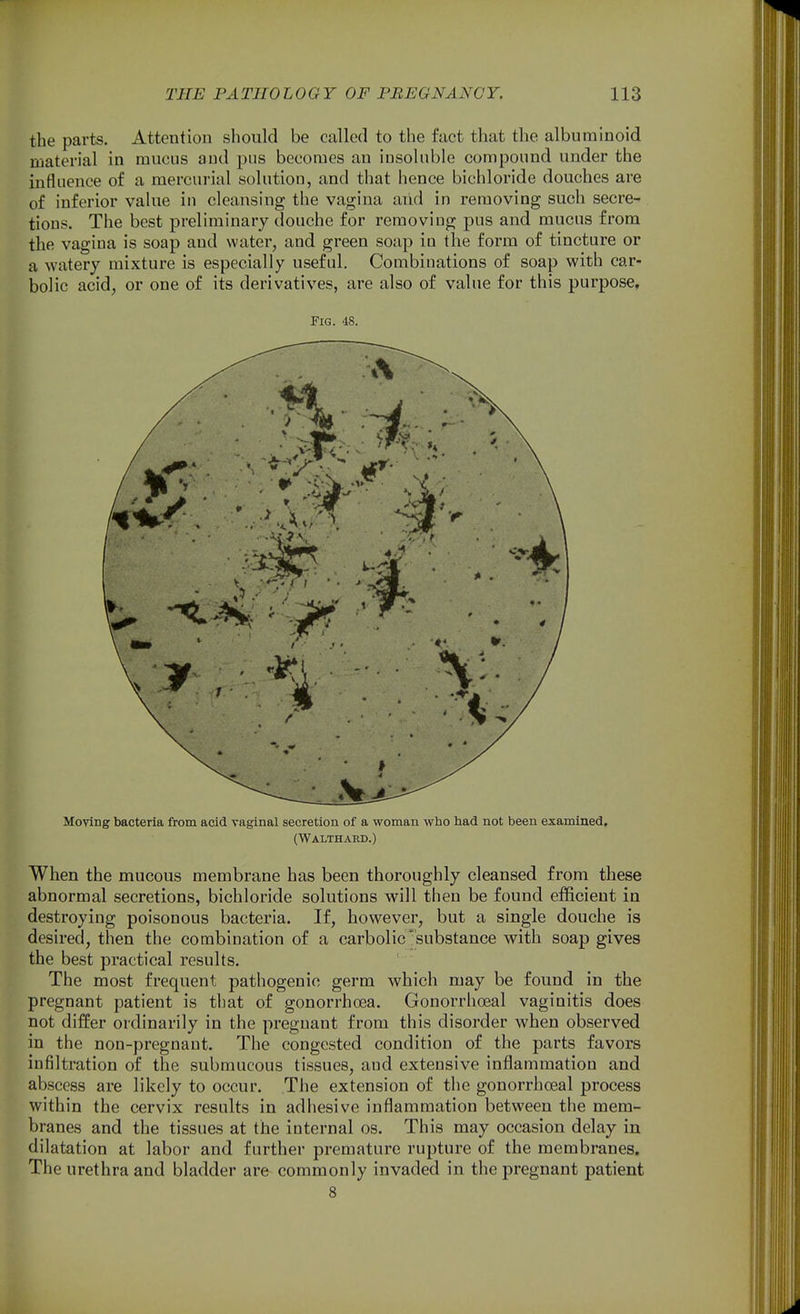 the parts. Attention should be called to the fact that the albuminoid material in mucus aud pus becomes an insoluble compound under the influence of a mercurial solution, and that hence bichloride douches are of inferior value in cleansing the vagina aiid in removing such secre- tions. The best preliminary douche for removing pus and mucus from the vagina is soap aud water, and green soap iu the form of tincture or a watery mixture is especially useful. Combinations of soap with car- bolic acid, or one of its derivatives, are also of value for this purpose. Fig. 48. Moving bacteria from acid vaginal secretion of a woman who had not been examined, (Walthard.) When the mucous membrane has been thoroughly cleansed from these abnormal secretions, bichloride solutions will then be found efficient in destroying poisonous bacteria. If, however, but a single douche is desired, then the combination of a carbolic'substance with soap gives the best practical results. The most frequent pathogenic germ which may be found in the pregnant patient is that of gonorrhoea. Gonorrhoeal vaginitis does not differ ordinarily in the pregnant from this disoi'der when observed in the non-pregnant. The congested condition of the parts favors infiltration of the submucous tissues, and extensive inflammation and abscess are likely to occur. The extension of the gonorrhoeal process within the cervix results in adhesive inflammation between the mem- branes and the tissues at the internal os. This may occasion delay in dilatation at labor and further premature rupture of the membranes. The urethra and bladder are commonly invaded in the pregnant patient 8