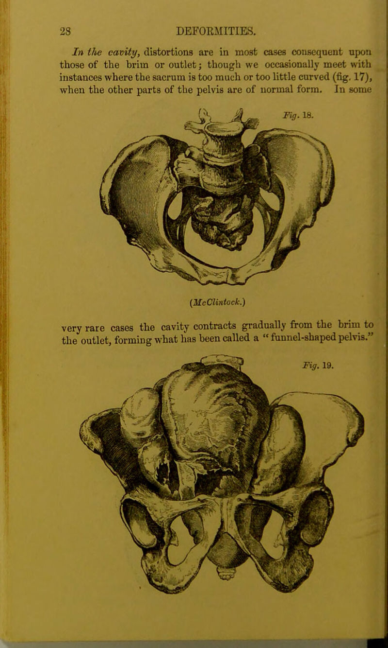 In the cavity, distortions are in most cases consequent upon those of the brim or outlet; though we occasionally meet with instances where the sacrum is too much or too little curved (fig. 17), when the other parts of the pelvis are of normal form. In some (McClintock.) very rare cases the cavity contracts gradually from the brim to the outlet, forming what has been called a  funnel-shaped pelvis. Fig. 19.