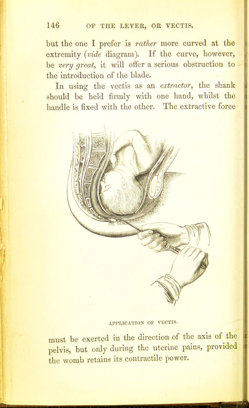 but the one I prefer is rather more curved at the extremity {vide diagram). If the curve, however, be very great, it will offer a serious obstruction to the introduction of the blade. In using the vectis as an extractor, the shank should be held firmly with one hand, whilst the handle is fixed with the other. The extractive force APPLICATION OF VECTIS. must be exerted in the direction of the axis of the pelvis, but only during the uterine pains, provided the womb retains its contractile power.