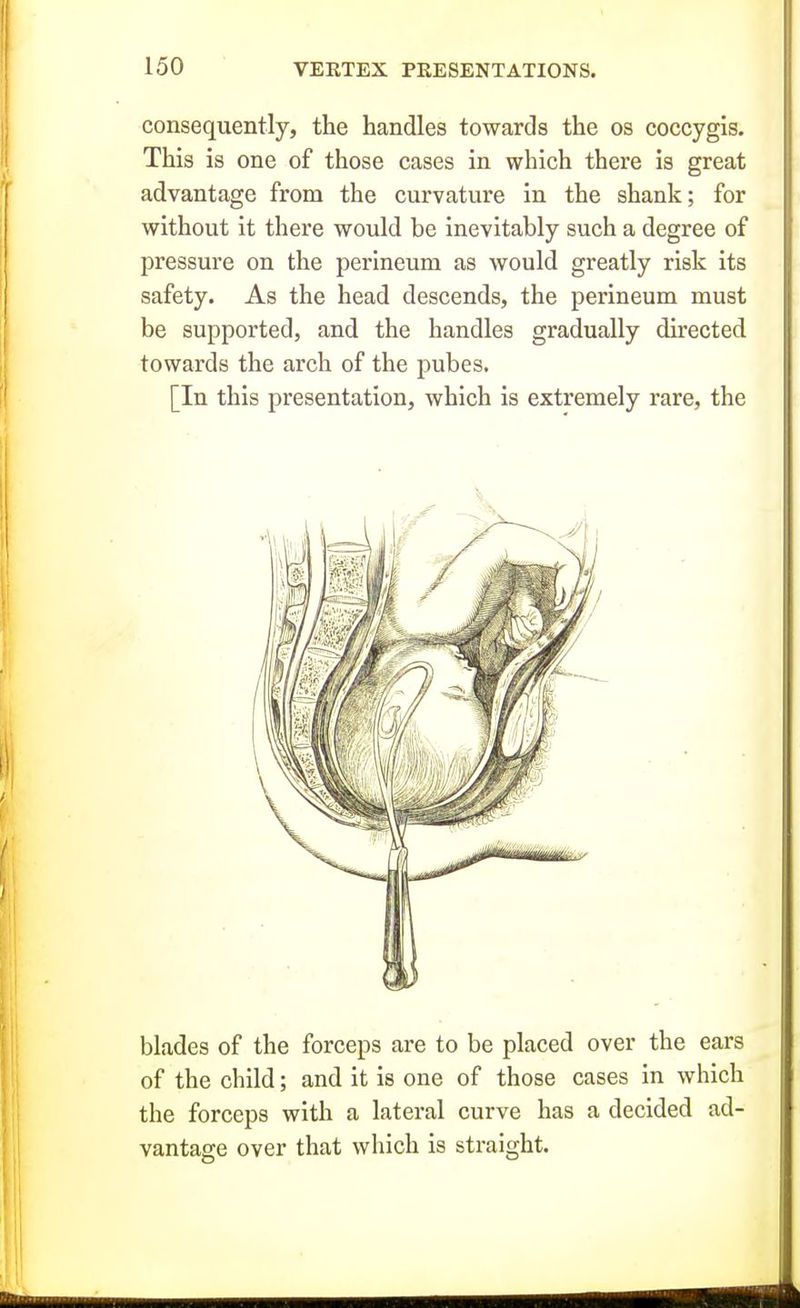 consequently, the handles towards the os coccygis. This is one of those cases in which there is great advantage from the curvature in the shank; for without it there would be inevitably such a degree of pressure on the perineum as would greatly risk its safety. As the head descends, the perineum must be supported, and the handles gradually directed towards the arch of the pubes. [In this presentation, which is extremely rare, the blades of the forceps are to be placed over the ears of the child; and it is one of those cases in which the forceps with a lateral curve has a decided ad- vantage over that which is straight.
