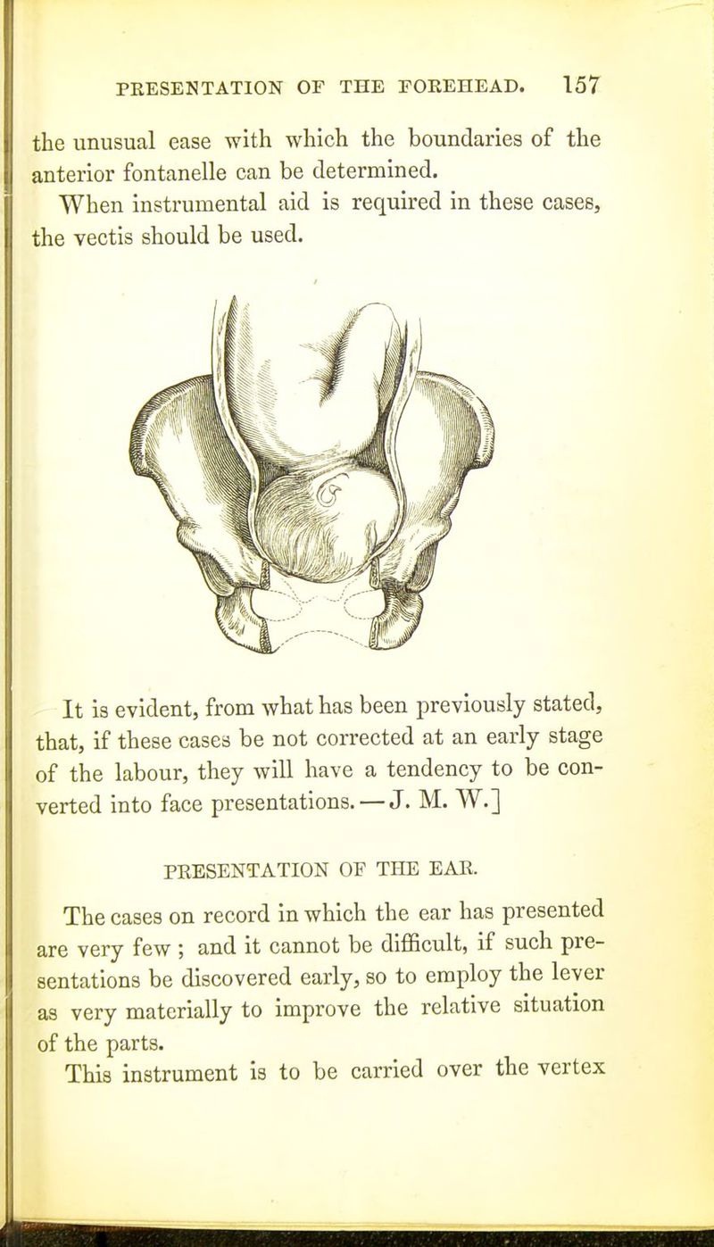 the unusual ease with which the boundaries of the anterior fontanelle can be determined. When instrumental aid is required in these cases, the vectis should be used. It is evident, from what has been previously stated, that, if these cases be not corrected at an early stage of the labour, they will have a tendency to be con- verted into face presentations. — J. M. W.] PRESENTATION OF THE EAR. The cases on record in which the ear has presented are very few ; and it cannot be difficult, if such pre- sentations be discovered early, so to employ the lever as very materially to improve the relative situation of the parts. This instrument is to be carried over the vertex I