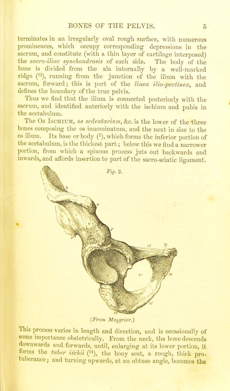 terminates in an irregularly oval rougli surface, with numerous prominences, which occupy corresponding depressions in the sacrum, and constitute (with a thin layer of cartilage interposed) the sacro-iliac synchondrosis of eacli side. The body of the bone is divided from the ala internally by a well-marked ridge ('2), running from the junction of the ilium with the sacrum, forward; this is part of the linea ilio-peotinea, and defines the boundary of the true pelvis. Thus we find that the ilium is connected posteriorly with the sacrum, and identified anteriorly with the ischium and pubis in the acetabulum. The Os Ischium, os sedentarmm, &c. is the lower of the three bones composing the os innominattmi, and the next in size to the OS ilium. Its base or body (), which forms the inferior portion of the acetabulum, is the thiclcest part; below this we find a narrower portion, from which a spinous process juts out backwards and inwards, and aflbrds insertion to part of the sacro-sciatic ligament. (From Mai/ijrier.) This process varies in length and direction, and is occasionally of some importance obstetrically. From the neck, the bone descends downwards and forwards, until, enlarging at its lower portion, it forms the iuher iscldi ('■»), the bony seat, a rough, thick pro- tuberance ; and turning upwards, at an obtuse angle, becomes the