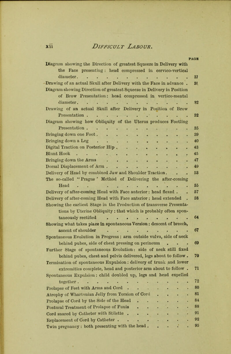 PAGK Diagram showing the Direction of greatest Squeeze in Delivery with the Face presenting : head compressed in cervico-vertical diameter 3J Drawing of an actual Skull after Delivery with the Face in advance . 31, Diagram showing Direction of greatest Squeeze in Delivery in Position of Brow Presentation: head compressed in vertico-mental diameter 32 Drawing of an actual Skull after Delivery in Position of Brow Presentation 32 Diagram showing how Obliquity of the Uterus produces Footling Presentation 35 Bringing down one Foot 39 Bringing down a Leg 40 Digital Traction on Posterior Hip 43 Blunt Hook .45 Bringing down the Arms 47 Dorsal Displacement of Ann 49 Delivery of Head by combined Jaw and Shoulder Traction. 53 The so-called  Prague ' Method of Delivering the after-coming Head . . . 55 Delivery of after-coming Head with Face anterior : head flexed . . 57 Delivery of after-coming Head with Face anterior : head extended . 58 Showing the earliest Stage in the Production of transverse Presenta- tions by Uterine Obliquity : that which is probably often spon- taneously rectified 64 Showing what takes place in spontaneous Version: descent of breech, ascent of shoulder 67 Spontaneous Evolution in Progress : arm outside vulva, side of neck behind pubes, side of chest pressing on perineum ... 69 Further Stage of spontaneous Evolution: side of neck still fixed behind pubes, chest and pelvis delivered, legs about to follow . 70 Termination of spontaneous Expulsion: delivery of trunk and lower extremities complete, head and posterior arm about to follow . 71 Spontaneous Expulsion: child doubled up, legs and head expelled together 72 Prolapse of Feet with Arms and Cord 80 Atrophy of Whartonian Jelly from Torsion of Cord .... 81 Prolapse of Cord by the Side of the Head 84 Postural Treatment of Prolapse of Funis 88 Cord snared by Catheter with Stilette 91 Replacement of Cord by Catheter 92 Twin pregnancy : both presenting with the head . . . . .95