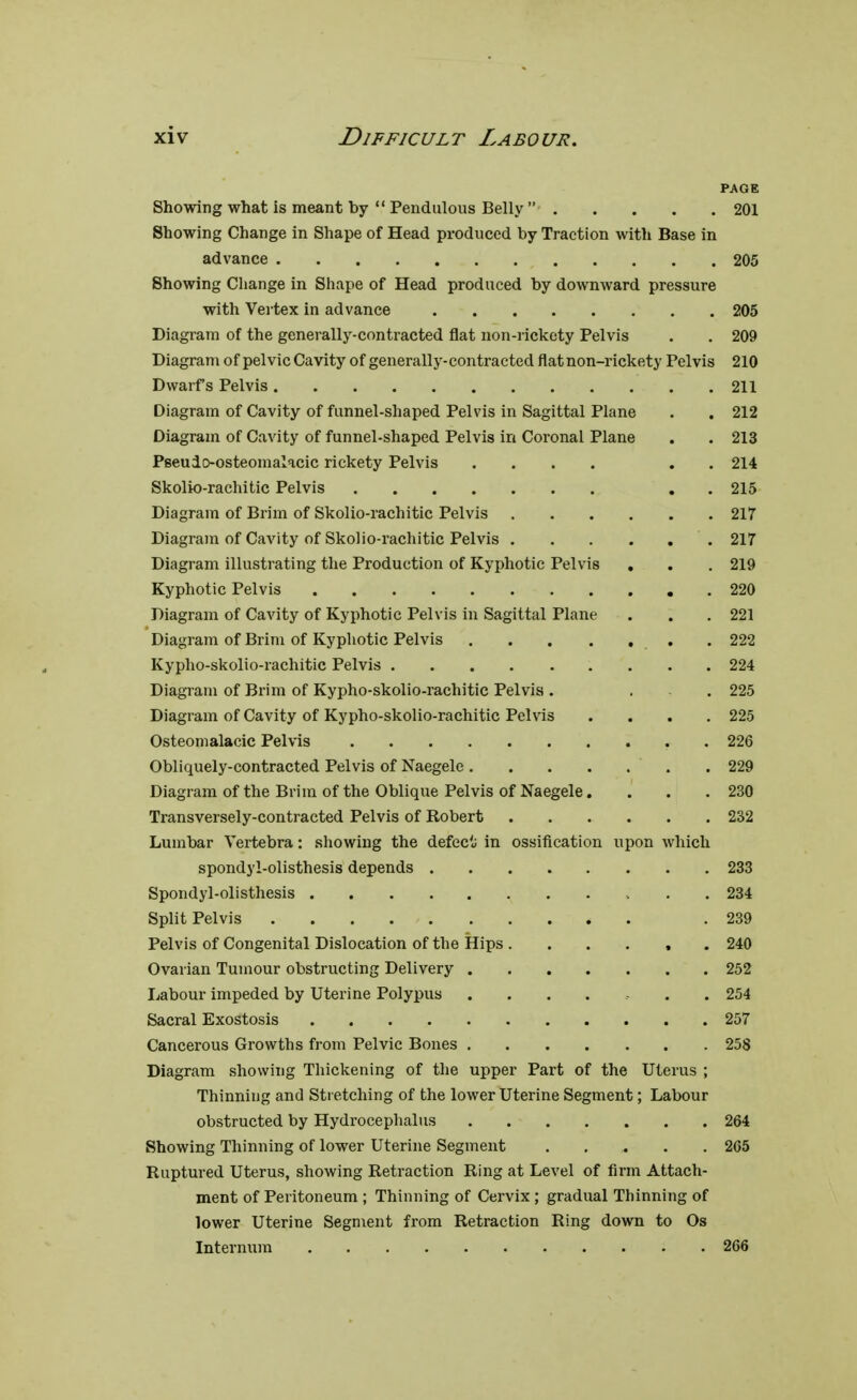 PAGE Showing what is meant by  Pendulous Belly  201 Showing Change in Shape of Head produced by Traction with Base in advance 205 Showing Change in Shape of Head produced by downward pressure with Vertex in advance 205 Diagram of the generally-contracted flat non-rickety Pelvis . . 209 Diagram of pelvic Cavity of generally-contracted flat non-rickety Pelvis 210 Dwarfs Pelvis .211 Diagram of Cavity of funnel-shaped Pelvis in Sagittal Plane . . 212 Diagram of Cavity of funnel-shaped Pelvis in Coronal Plane . . 213 Pseudo-osteomalacic rickety Pelvis .... . . 214 Skolio-rachitic Pelvis . 215 Diagram of Brim of Skolio-rachitic Pelvis 217 Diagram of Cavity of Skolio-rachitic Pelvis 217 Diagram illustrating the Production of Kyphotic Pelvis . . . 219 Kyphotic Pelvis 220 Diagram of Cavity of Kyphotic Pelvis in Sagittal Plane . . . 221 Diagram of Brim of Kyphotic Pelvis 222 Kypho-skolio-rachitic Pelvis 224 Diagram of Brim of Kypho-skolio-rachitic Pelvis . . 225 Diagram of Cavity of Kypho-skolio-rachitic Pelvis .... 225 Osteomalacic Pelvis . 226 Obliquely-contracted Pelvis of Naegele 229 Diagram of the Brim of the Oblique Pelvis of Naegele.... 230 Transversely-contracted Pelvis of Robert 232 Lumbar Vertebra: showing the defect in ossification upon which spondylolisthesis depends 233 Spondylolisthesis 234 Split Pelvis .239 Pelvis of Congenital Dislocation of the Hips ...... 240 Ovarian Tumour obstructing Delivery 252 Labour impeded by Uterine Polypus ....... 254 Sacral Exostosis 257 Cancerous Growths from Pelvic Bones 258 Diagram showing Thickening of the upper Part of the Uterus ; Thinning and Stretching of the lower Uterine Segment; Labour obstructed by Hydrocephalus 264 Showing Thinning of lower Uterine Segment 265 Ruptured Uterus, showing Retraction Ring at Level of firm Attach- ment of Peritoneum ; Thinning of Cervix ; gradual Thinning of lower Uterine Segment from Retraction Ring down to Os Internum 266
