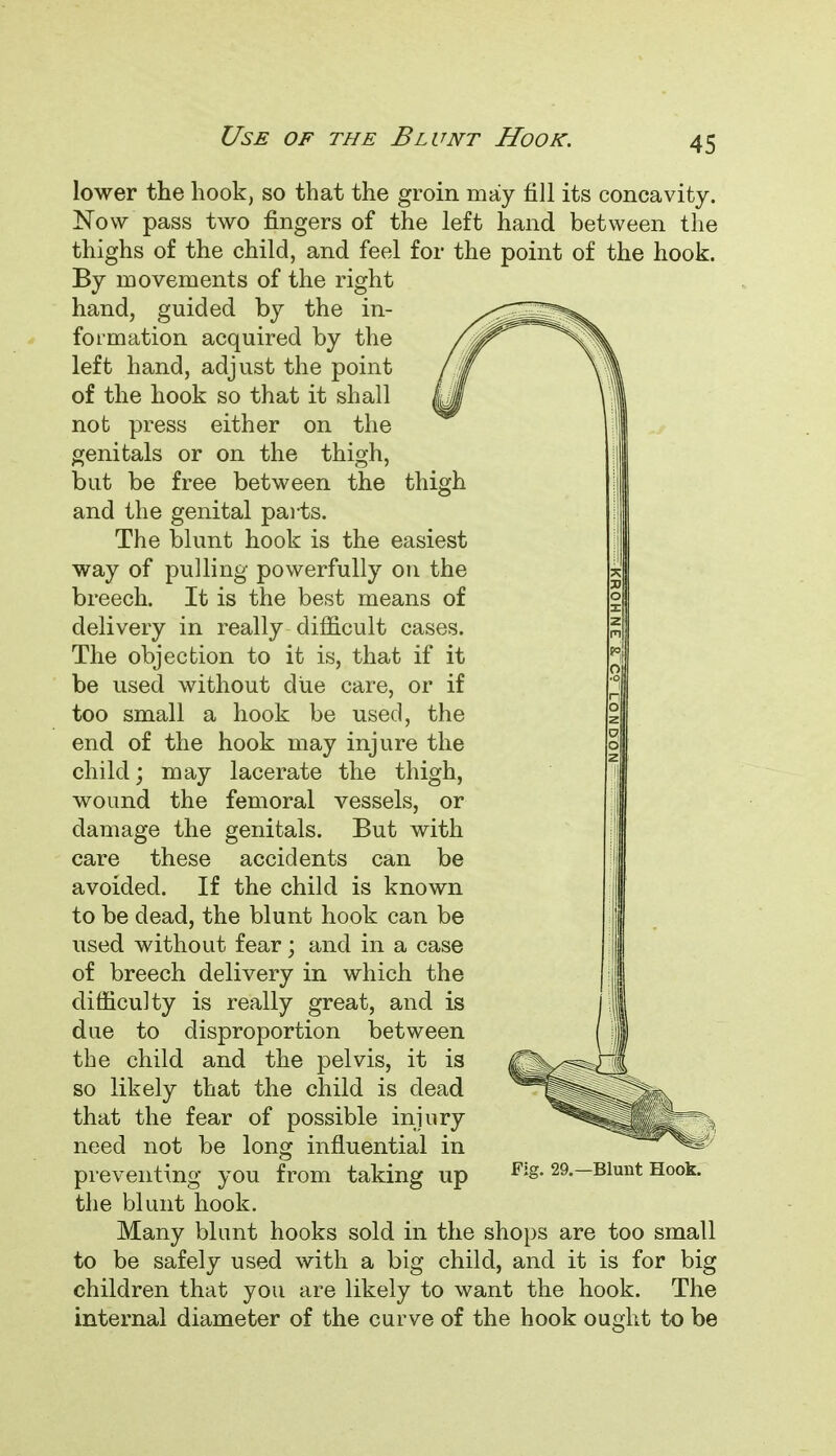 Use of the Blunt Hook. thigh lower the hook, so that the groin may fill its concavity. Now pass two fingers of the left hand between the thighs of the child, and feel for the point of the hook. By movements of the right hand, guided by the in- formation acquired by the left hand, adjust the point of the hook so that it shall not press either on the genitals or on the thigh, but be free between the and the genital parts. The blunt hook is the easiest way of pulling powerfully on the breech. It is the best means of delivery in really difficult cases. The objection to it is, that if it be used without due care, or if too small a hook be used, the end of the hook may injure the child; may lacerate the thigh, wound the femoral vessels, or damage the genitals. But with care these accidents can be avoided. If the child is known to be dead, the blunt hook can be used without fear; and in a case of breech delivery in which the difficulty is really great, and is due to disproportion between the child and the pelvis, it is so likely that the child is dead that the fear of possible injury need not be long influential in preventing you from taking up the blunt hook. Many blunt hooks sold in the shops are too small to be safely used with a big child, and it is for big children that you are likely to want the hook. The internal diameter of the curve of the hook ought to be Fig. 29.—Blunt Hook.