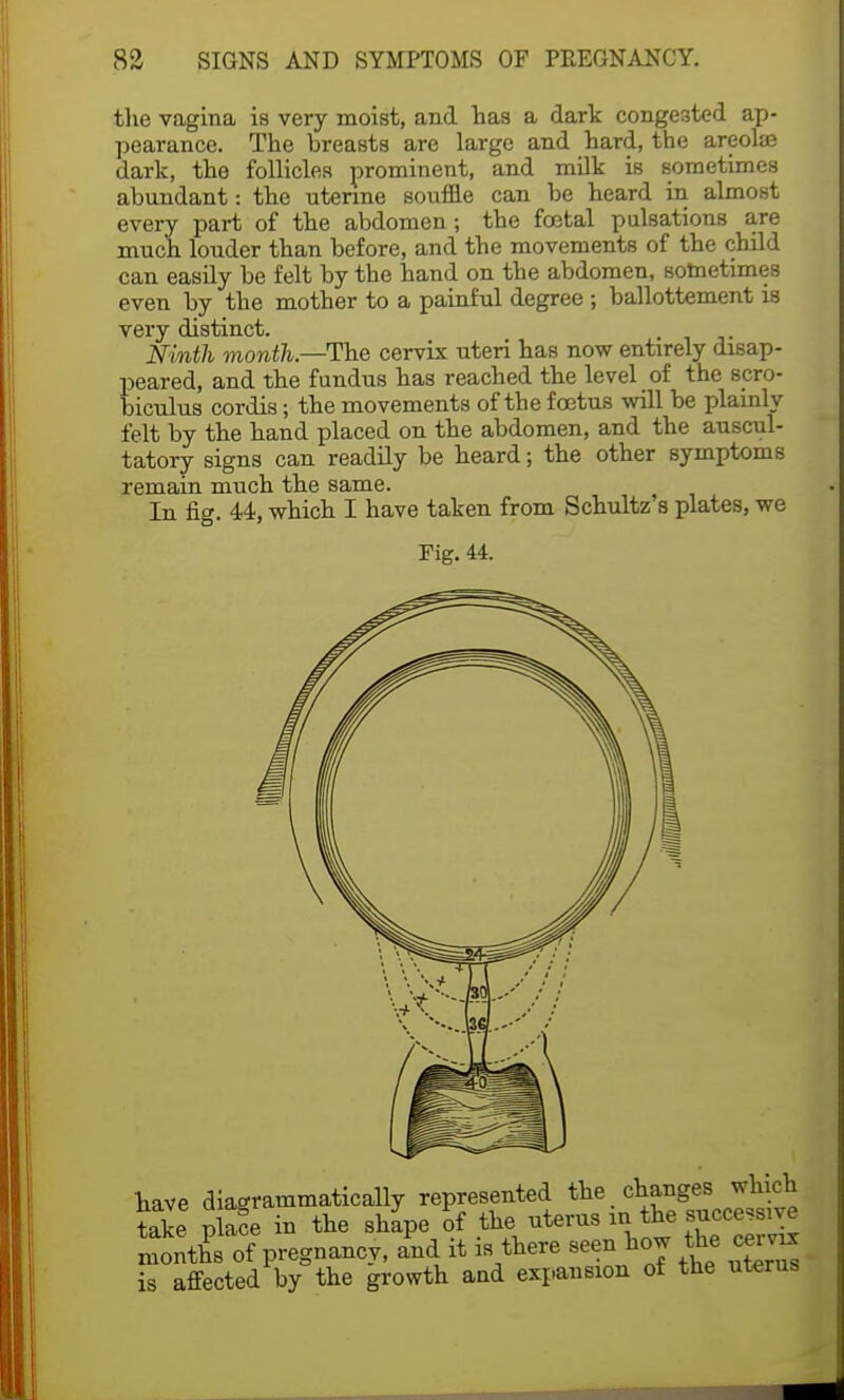 the vagina is very moist, and has a dark congested ap- pearance. The breasts are large and hard, the areolae dark, the follicles prominent, and milk is sometimes abundant: the uterine souffle can be heard in almost every part of the abdomen; the foetal pulsations are much louder than before, and the movements of the child can easily be felt by the hand on the abdomen, sometimes even by the mother to a painful degree ; ballottement is very distinct. Ninth month—The cervix uteri has now entirely disap- peared, and the fundus has reached the level of the scro- biculus cordis; the movements of the foetus will be plainly felt by the hand placed on the abdomen, and the auscul- tatory signs can readily be heard; the other symptoms remain much the same. In fig. 44, which I have taken from Schultz s plates, we Fig. 44. have diagrammatically represented the changes which take p ace in the shape of the uterus in the successive months of pregnancy, aPnd it is there seen how the cemx is affected by the growth and expansion of the uterus