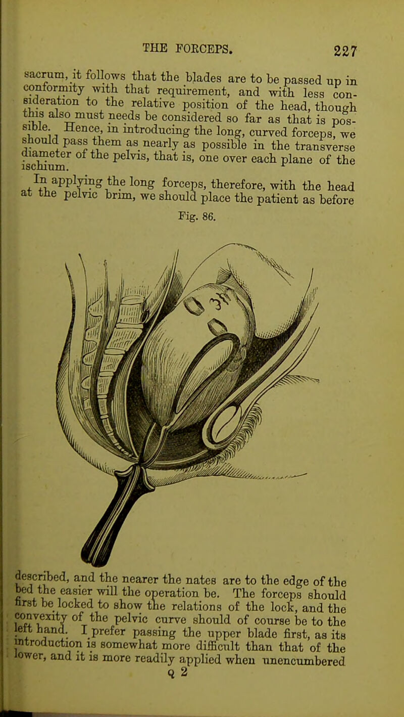 sacrum, it follows that the bjades are to be passed up in conformity with that requirement, and with less con- sideration to the relative position of the head, though this also must needs be considered so far as that is pos- sible Hence, m mtroducing the long, curved forcepsf we should pass them as nearly as possible in the transverse ischium P that is' °ne °Ver each plane of the In applying the long forceps, therefore, with the head at the pelvic brim, we should place the patient as before Fig. 86. described, and the nearer the nates are to the edge of the bed the easier will the operation be. The forceps should nrst be locked to show the relations of the lock, and the convexity of the pelvic curve should of course be to the left hand. I prefer passing the upper blade first, as its introduction is somewhat more difficult than that of the lower, and it is more readily applied when unencumbered q 2