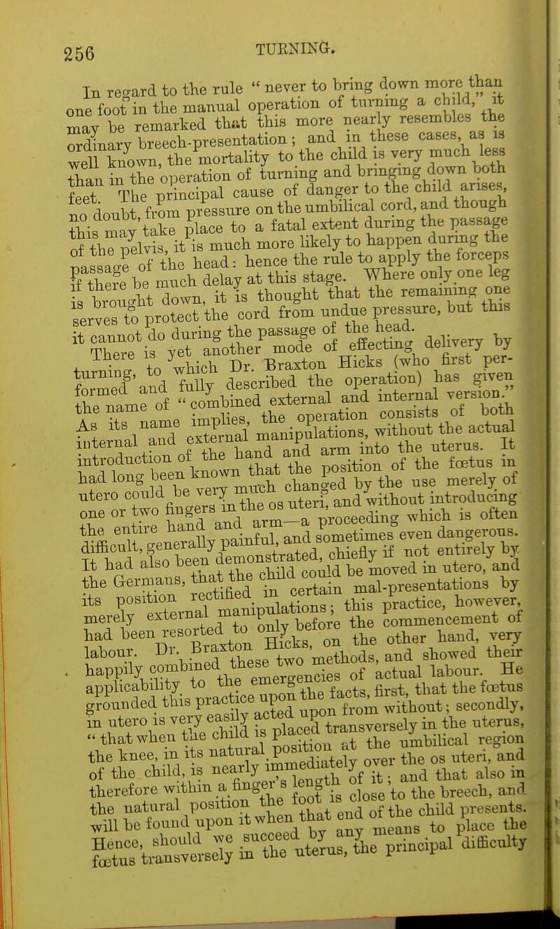 In regard to the rule  never to bring down more than one foot in the manual operation of turning a child, it may be remarked that this more nearly resembles the Xiary breech-presentation; and in these cases as is wel known, the mortality to the child is very much less Than in the operation of turning and bringing down both feet The principal cause of danger to the child arises no doubt from pressure on the umbilical cord, and though fhif may take place to a fatal extent during the passage of ?5Smuch more likely to happen during the IssaVe of the head: hence the rule to apply the forceps Iff be much delay at this stage. Where only one leg •Sit down, it is thought that the remaining^one serves to protect the cord from undue pressure, but this  ^h^ra 5 ^delivery by I ZLame of  combined external and internal version SS^ofSUand a|d a-tae nteraas £ ^Z^^^^ffi**? nse merely, of ntero could tie veiy p ith t mtroducmg one or two fingers in the,os ute1^ ^ wllich is 0ften % etln::Xt^^ sCetime^even dangerous. ffi£ 'a£^beenTmonstrated, chiefly if not entirely by. It had also oeeu moved in utero, and the Germans, nat the cMd cou^ ^ hj its position recwneiA ,iractice, however, merely external -^fSe S Kmencement of had been resorted to 0ngbelore yery labour. Dl--h.^tXsftir,m0e?hods, and showed their • happily combined t™°ncies of actual labour. He &WlW'tttLtato S the facts, first, that the foetus grounded this pi act ce upo without; secondly, in utero is very easily ^c^3Tran8versely in the uterus, « that when the chl J P^^XeUmbilical region the knee, m its natural P0^. , , the os uteri, and of the child is ^^/y^XS^K and that also in therefore within a finger s length o it ^ the natural position the foot is close ^ will be found upon it when that end o place the ^S'^^:^^ P^pal acuity