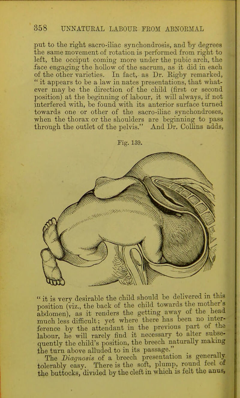 put to the right sacro-iliac synchondrosis, and by degrees the same movement of rotation is performed from right to left, the occiput coming more under the pubic arch, the face engaging the hollow of the sacrum, as it did in each of the other varieties. In fact, as Dr. Kigby remarked,  it appears to be a law in nates presentations, that what- ever may be the direction of the child (first or second position) at the beginning of labour, it will always, if not interfered with, be found with its anterior surface turned towards one or other of the sacro-iliac synchondroses, when the thorax or the shoulders are beginning to pass through the outlet of the pelvis. And Dr. Collins adds, Fig. 139.  it is very desirable the child should be delivered m this position (viz., the back of the child towards the mother s abdomen), as it renders the getting away of the head much less difficult; yet where there has been no inter- ference by the attendant in the previous part of the labour, he will rarely find it necessary to alter subse- quently the child's position, the breech naturally making tiie turn above alluded to in its passage. The Diagnosis of a breech presentation is generally, tolerably easy. There is the soft, plump, round feel of the buttocks, divided by the cleft in which is felt the anus,