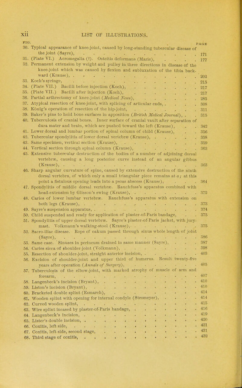 30. Typical appearance of knee-joint, caused by long-standing tubercular disease of tlie joint (Sayre), j^yj^ 31. (Plate VI.) Acromegalia (?). Osteitis deformans (Marie), .... 177 33. Permanent extension by weight and pulley in three directions in disease of the knee-joint which was caused by flexion and subluxation of the tibia back- ward (Krause), . 202 33. Koch's syringe, 215 34. (Plate VII.) Bacilli before injection (Koch), 217 35. (Plate VII.) Bacilli after injection (Koch), 217 36. Partial arthrectomy of knee-joint (Medical JS^evjs), 285 37. Atypical resection of knee-joint, witli splicing of articular ends 308 38. Kouig's operation of resection of the hip-joint, 311 39. Baker's pins to hold bone surfaces in apposition (Britiih Medical Journal), . . 315 40. Tuberculosis of cranial bones. Inner surface of cranial vault after separation of dura mater and brain, which are pushed toward the left (Krause), . . 342 41. Lower dorsal and lumbar portion of spinal column of child (Krause), . . 356 42. Tubercular spondylitis of lower dorsal vertebrae (Krause), . . . . . 358 43. Same specimen, vertical section (Krause), 359 44. Vertical section through spinal column (Krause), 363 45. Extensive tubercular destruction of the bodies of a number of adjoining dorsal vertebrie, causing a long posterior curve instead of an angular gibbus (Krause), . 363 46. Sharp angular curvature of spine, caused by extensive destruction of the ninth dorsal vertebra, of which only a small triangular piece remains at a; at this point a fistulous opening leads into a psoas abscess (Krause), . . . 364 47. Spondylitis of middle dorsal vertebroe. Rauchfuss's apparatus combined with head-extension by Glisson's swing (Krause), 372 48. Caries of lower lumbar vertebrae. Rauchfuss's apparatus with extension on both legs (Krause), 373 49. Sayre's suspension apparatus, 374 50. Child suspended and ready for application of plaster-of-Paris bandage, . . 375 51. Spondylitis of upper dorsal vertebra;. Sayre's plaster-of-Paris jacket, with jury- mast. Volkmann's walking-stool (Krause), 375 52. Sacro-iliac disease. Rope of oakum passed through sinus whole length of joint (Sayre), 386 .53. Same case. ' Sinuses in perineum drained iu same manner (Sayre), . . . 387 .54. Caries sicca of Bhoulder-joint (Volkmann), 398 55. Resection of shoulder-joint, straight anterior incision, 403 56. Excision of shoulder-joint and upper third of humerus. Result twents'-flve years after operation (J.»iraa?s o/<570',7e)7/), 405 57. Tuberculosis of the elbow-joint, with marked atrophy of muscle of arm and forearm, 'W7 .58. Langenbeck's incision (Bryant), 410 59. Liston's incision (Bryant), 410 60. Bracketed double splint (Esmarch), 414 61. Wooden splint with opening for internal condyle (Stromeyer), .... 414 62. Curved wooden splint, • • 415 63. Wire splint incased by plaster-of-Paris bandage, 416 64. Langenbeck's incision, 419 65. Lister's double incision, 420 66. Coxitis, left side, 431 67. Coxitis, left side, second stage, 431 68. Third stage of coxitis, 432