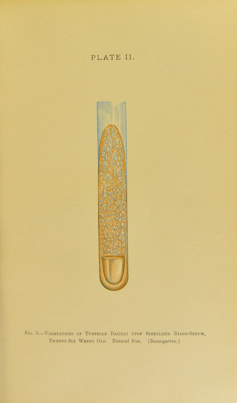 Vu;. 3.—Vkoetatiosh of Tubekclk Bacilli upon Stebilized Blood-Serum, TwK5TV-Six Weeks Old. Natural Size. (Baumgarten.)
