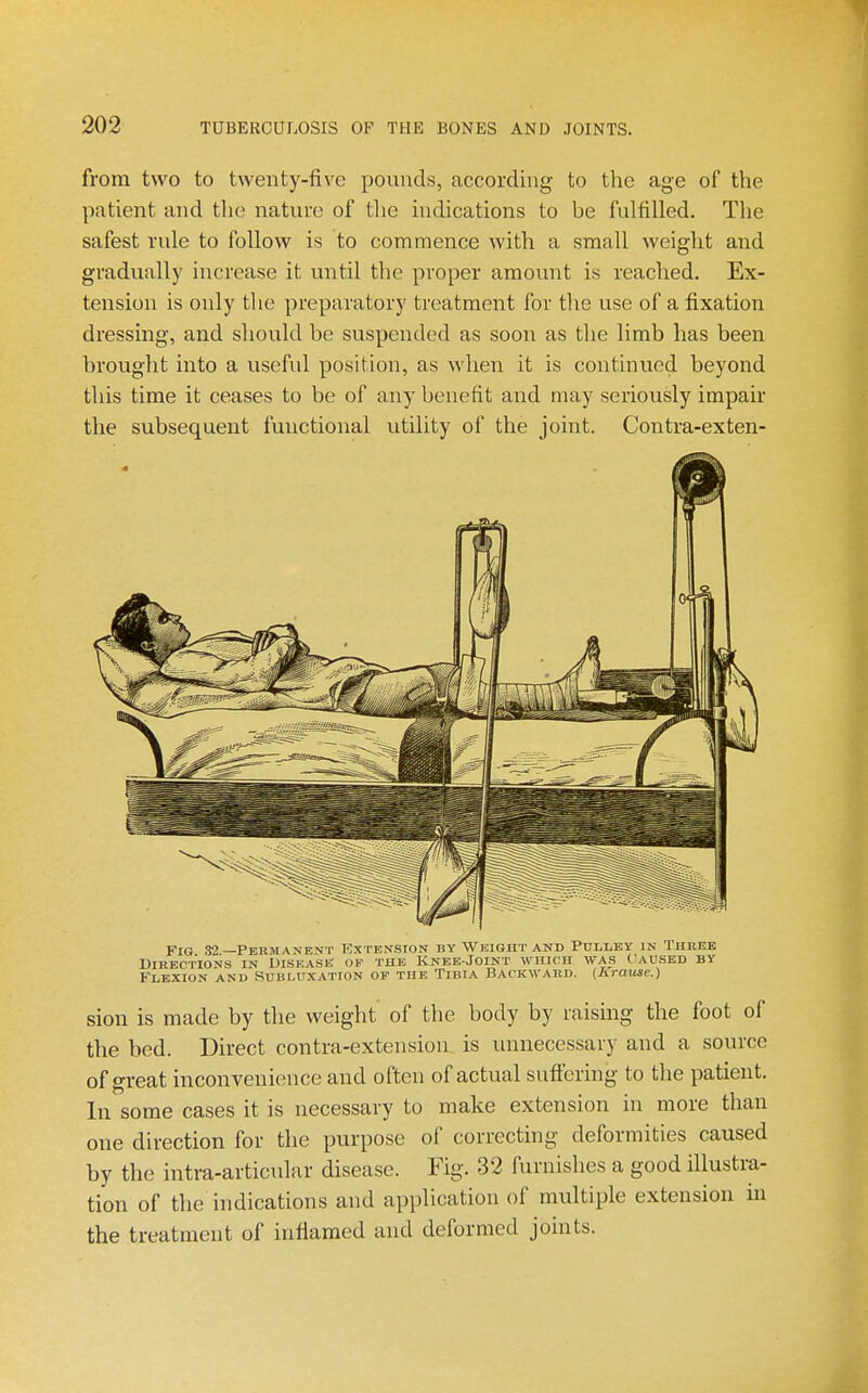 from two to twenty-five pounds, according to tlie age of the patient and the nature of the indications to be fulfilled. The safest rule to follow is to commence with a small weight and gradually increase it until the proper amount is reached. Ex- tension is only the preparatory treatment for the use of a fixation dressing, and should be suspended as soon as the limb has been brought into a useful position, as when it is continued beyond this time it ceases to be of any benefit and may seriously impair the subsequent functional utility of the joint. Contra-exten- FiG 32—Permanent Extension by Weight and Pulley in Three Directions in Disease of the Knee-Joint which was C'aused by Flexion and Subluxation of the Tibia Backward. {Arause.) sion is made by the weight of the body by raising the foot of the bed. Direct contra-extension is unnecessary and a source of great inconvenience and often of actual suffering to the patient. In some cases it is necessary to make extension in more than one direction for the purpose of correcthig deformities caused by the intra-articular disease. Fig. 32 furnishes a good illustra- tion of the indications and application of multiple extension in the treatment of inflamed and deformed joints.