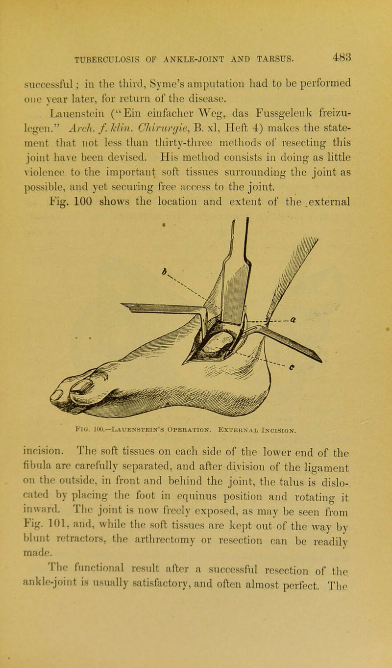 successful; in the third, Syme's amputation liad to be performed Olio year later, for return of the disease. Lauenstein (Ein einfacher Weg, das Fussgelenk freizu- legen. Arch. f. Idin. Chirurgie, B. xl. Heft 4) makes the state- ment that not less than thirty-three methods ol' resecting this joint have been devised. His method consists in doing as little violence to the important soft tissues surrounding the joint as possible, and yet securing free access to the joint. Fig. 100 shows the location and extent of the .external Fig. 100.—Lauenstein's Operation. External Incision. incision. The soft tissues on each side of the lower end of the fibul a are carefully separated, and after division of the ligament on the outside, in front and behind the joint, the talus is dislo- cated by placing the foot in equinus position and rotating it inward. The joint is now freely exposed, as may be seen from Fig. 101, and, while the soft tissues are kept out of the way by blunt retractors, the arthrectomy or resection can be readily made. The functional result after a successful resection of the ankle-joint is usually satisfactory, and often almost perfect. The