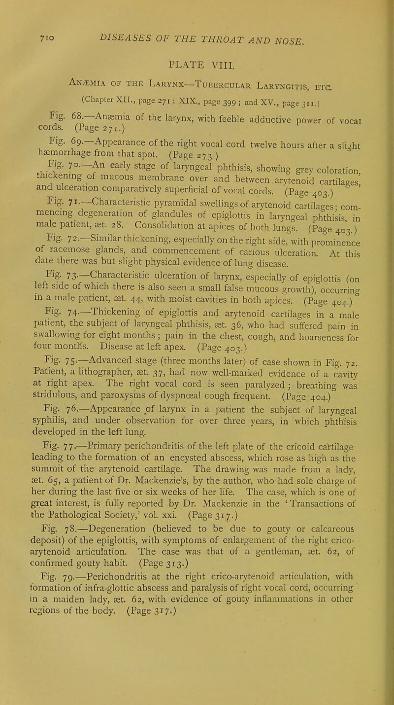 PLATE VIII. An/Emia of the Larynx—Tubercular Laryngitis, ktc. (Chapter XII., page 271 : XIX., page 399 ; and XV., page 311.) Fig. 68.—Antemia of the larynx, with feeble adductive power of vocal cords. (Page 271.) Fig. 69.—Appearance of the right vocal cord twelve hours after a slight haemorrhage from that spot. (Page 273.) Fig. 7o.-An early stage of laryngeal phthisis, showing grey coloration, thickening of mucous membrane over and between arytenoid cartilages and ulceration comparatively superficial of vocal cords. (Page 403.) ' Fig. 71.—Characteristic pyramidal swellings of arytenoid cartilages - com- mencing degeneration of glandules of epiglottis in laryngeal phthisis in male patient, st. 28. Consolidation at apices of both lungs. (Page 403.) Fig. 72.—Similar thickening, especially on the right side, with prominence of racemose glands, and commencement of carious ulceration. At this date there was but slight physical evidence of lung disease. Fig- 73-—Characteristic ulceration of larynx, especially of epiglottis (on left side of which there is also seen a small false mucous growth), occurring in a male patient, est. 44, with moist cavities in both apices. (Page 404.) Fig- 74-—Thickening of epiglottis and arytenoid cartilages in a male patient, the subject of laryngeal phthisis, set. 36, who had suffered pain in swallowing for eight months; pain in the chest, cough, and hoarseness for four months. Disease at left apex. (Page 403.1 Fig- 75-—Advanced stage (three months later) of case shown in Fig. 72. Patient, a lithographer, set. 37, had now well-marked evidence of a cavity at right apex. The right vocal cord is seen paralyzed ; breathing was stridulous, and paroxysms of dyspnoeal cough frequent. (Pa,c'e 404.) Fig. 76.—Appearance of larynx in a patient the subject of laryngeal syphilis, and under observation for over three years, in which phthisis developed in the left lung. Fig- 77-—Primary perichondritis of the left plate of the cricoid cartilage leading to the formation of an encysted abscess, which rose as high as the summit of the arytenoid cartilage. The drawing was made from a lady, set. 65, a patient of Dr. Mackenzie's, by the author, who had sole charge of her during the last five or six weeks of her life. The case, which is one of great interest, is fully reported by Dr. Mackenzie in the ' Transactions of the Pathological Society,' vol. xxi. (Page 317.) Fig. 78.—Degeneration (believed to be due to gouty or calcareous deposit) of the epiglottis, with symptoms of enlargement of the right crico- arytenoid articulation. The case was that of a gentleman, a;t. 62, of confirmed gouty habit. (Page 313.) Fig. 79.—Perichondritis at the right crico-arytenoid articulation, with formation of infra-glottic abscess and paralysis of right vocal cord, occurring in a maiden lady, set. 62, with evidence of gouty inflammations in other regions of the body. (Page 317.)