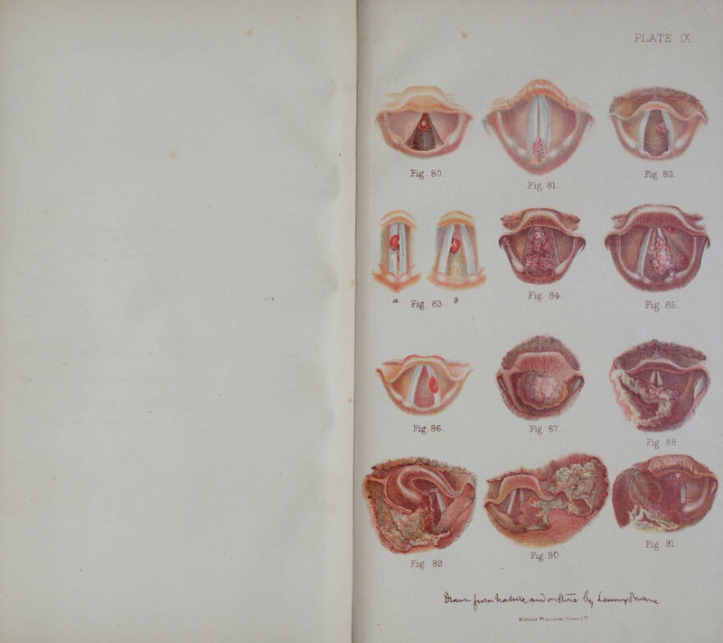 Jig. 80. Fig. 81. K.g. 82. i Fig. 83, Fig. 84. Fig. 85. Fig. 89. Fig. 90 Fig. 91.