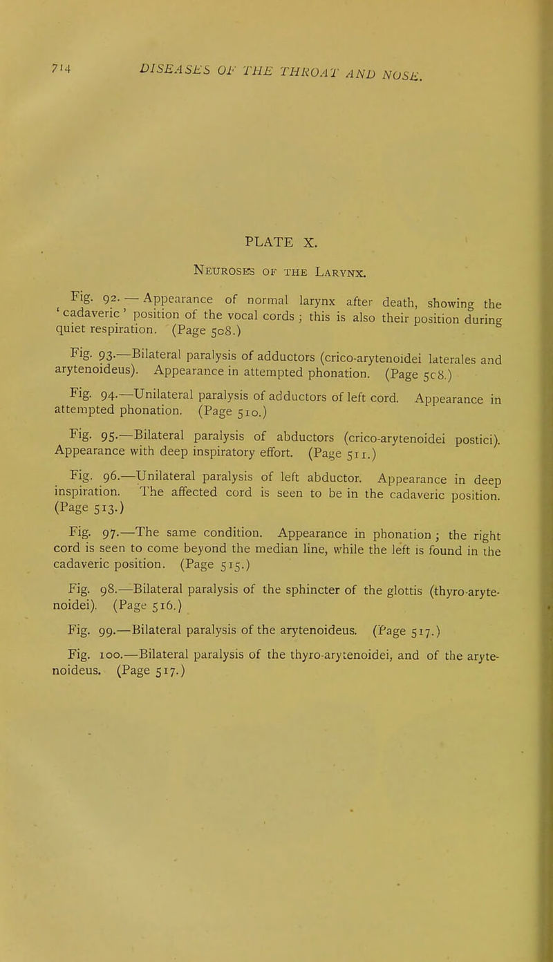 PLATE X. Neuroses of the Larynx. Fig. 92. — Appearance of normal larynx after death, showing the ' cadaveric ' position of the vocal cords ; this is also their position during quiet respiration. (Page 508.) Fig- 93-—Bilateral paralysis of adductors (crico-arytenoidei kterales and arytenoideus). Appearance in attempted phonation. (Page 508.) Fig. 94.—Unilateral paralysis of adductors of left cord. Appearance in attempted phonation. (Page 510.) Fig- 9S-—Bilateral paralysis of abductors (crico-arytenoidei postici). Appearance with deep inspiratory effort. (Page 511.) Fig. 96.—Unilateral paralysis of left abductor. Appearance in deep inspiration. The affected cord is seen to be in the cadaveric position. (Page 513.) Fig- 97-—The same condition. Appearance in phonation ; the right cord is seen to come beyond the median line, while the left is found in the cadaveric position. (Page 515.) Fig. 98.—Bilateral paralysis of the sphincter of the glottis (thyro-aryte- noidei). (Page 516.) Fig. 99.—Bilateral paralysis of the arytenoideus. (Page 517.) Fig. 100.—Bilateral paralysis of the thyro-arytenoidei, and of the aryte- noideus. (Page 517.)