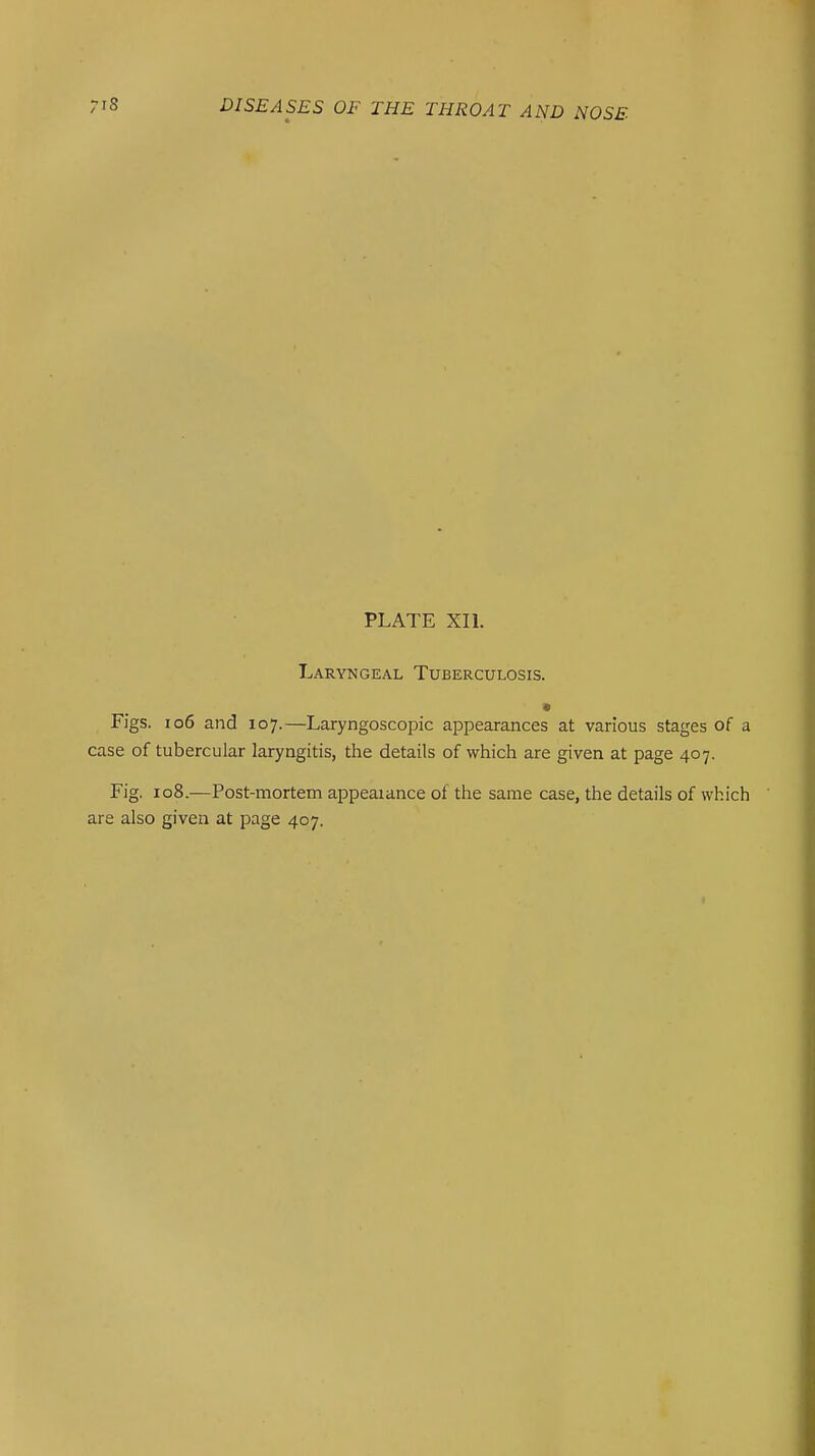 PLATE XIl. Laryngeal Tuberculosis. Figs. 106 and 107.—Laryngoscopic appearances at various stages of a case of tubercular laryngitis, the details of which are given at page 407. Fig. 108.—Post-mortem appeaiance of the same case, the details of which are also given at page 407.