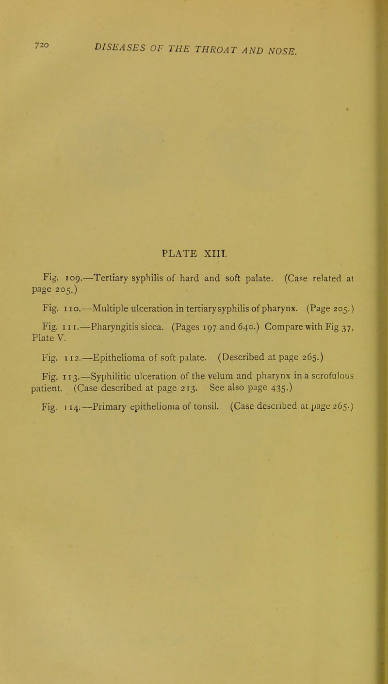 PLATE XIII. Fig. 109.—Tertiary syphilis of hard and soft palate. (Case related at page 205.) Fig. no.—Multiple ulceration in tertiary syphilis of pharynx. (Page 205.) Fig. 111.—Pharyngitis sicca. (Pages 197 and 640.) Compare with Fig 37, Plate V. Fig. 112.—Epithelioma of soft palate. (Described at page 265.) Fig. 113.—Syphilitic ulceration of the velum and pharynx in a scrofulous patient. (Case described at page 213. See also page 435.) Fig. 114.—Primary epithelioma of tonsil. (Case described at j[jage 265.)