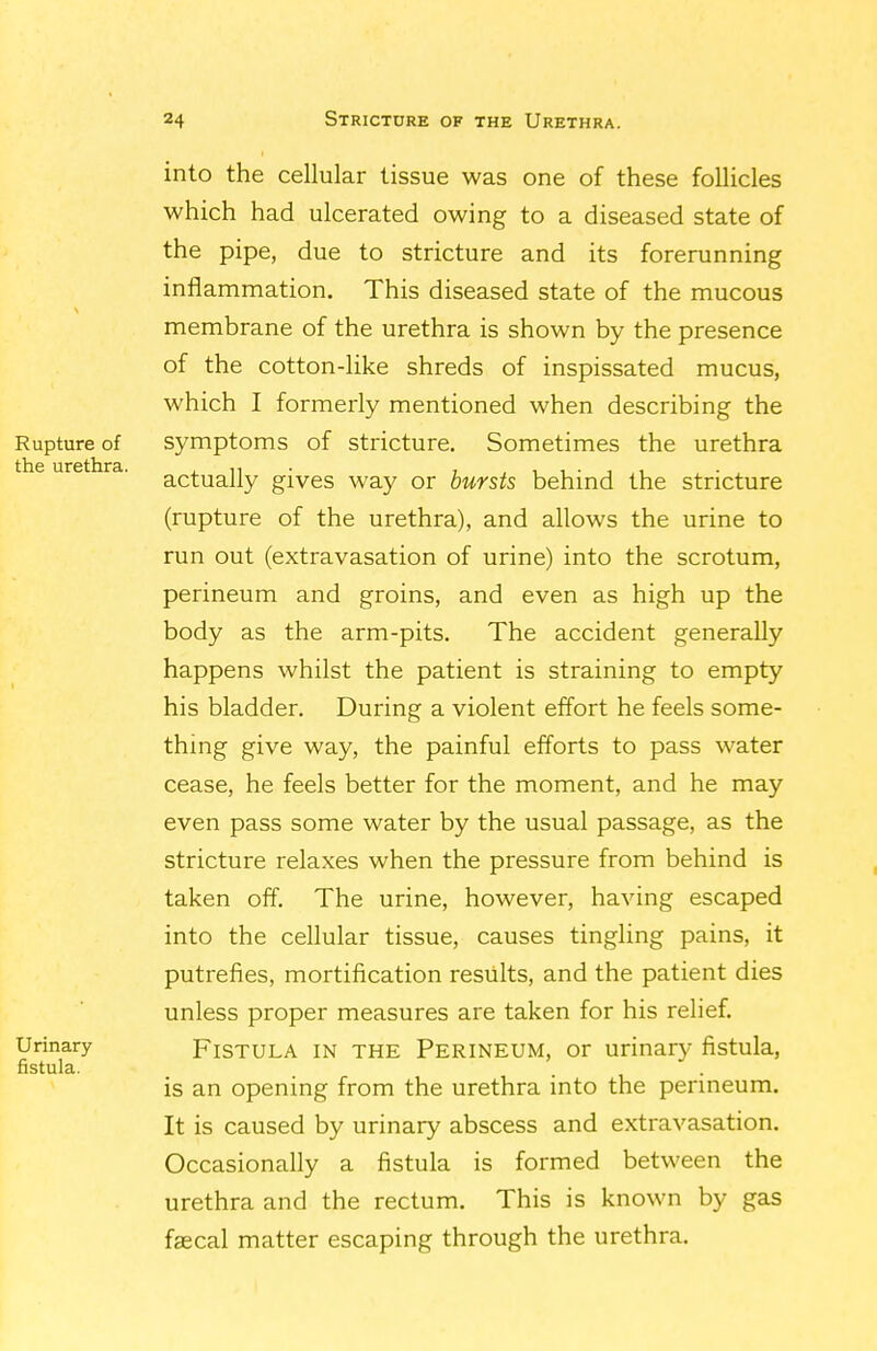 into the cellular tissue was one of these follicles which had ulcerated owing to a diseased state of the pipe, due to stricture and its forerunning inflammation. This diseased state of the mucous membrane of the urethra is shown by the presence of the cotton-like shreds of inspissated mucus, which I formerly mentioned when describing the Rupture of symptoms of stricture. Sometimes the urethra actually gives way or bursts behind the stricture (rupture of the urethra), and allows the urine to run out (extravasation of urine) into the scrotum, perineum and groins, and even as high up the body as the arm-pits. The accident generally happens whilst the patient is straining to empty his bladder. During a violent effort he feels some- thing give way, the painful efforts to pass water cease, he feels better for the moment, and he may even pass some water by the usual passage, as the stricture relaxes when the pressure from behind is taken off. The urine, however, having escaped into the cellular tissue, causes tingling pains, it putrefies, mortification results, and the patient dies unless proper measures are taken for his relief. Urinary FiSTULA IN THE PERINEUM, or urinary fistula, fistula. . is an opening from the urethra into the permeum. It is caused by urinary abscess and extravasation. Occasionally a fistula is formed between the urethra and the rectum. This is known by gas faecal matter escaping through the urethra.