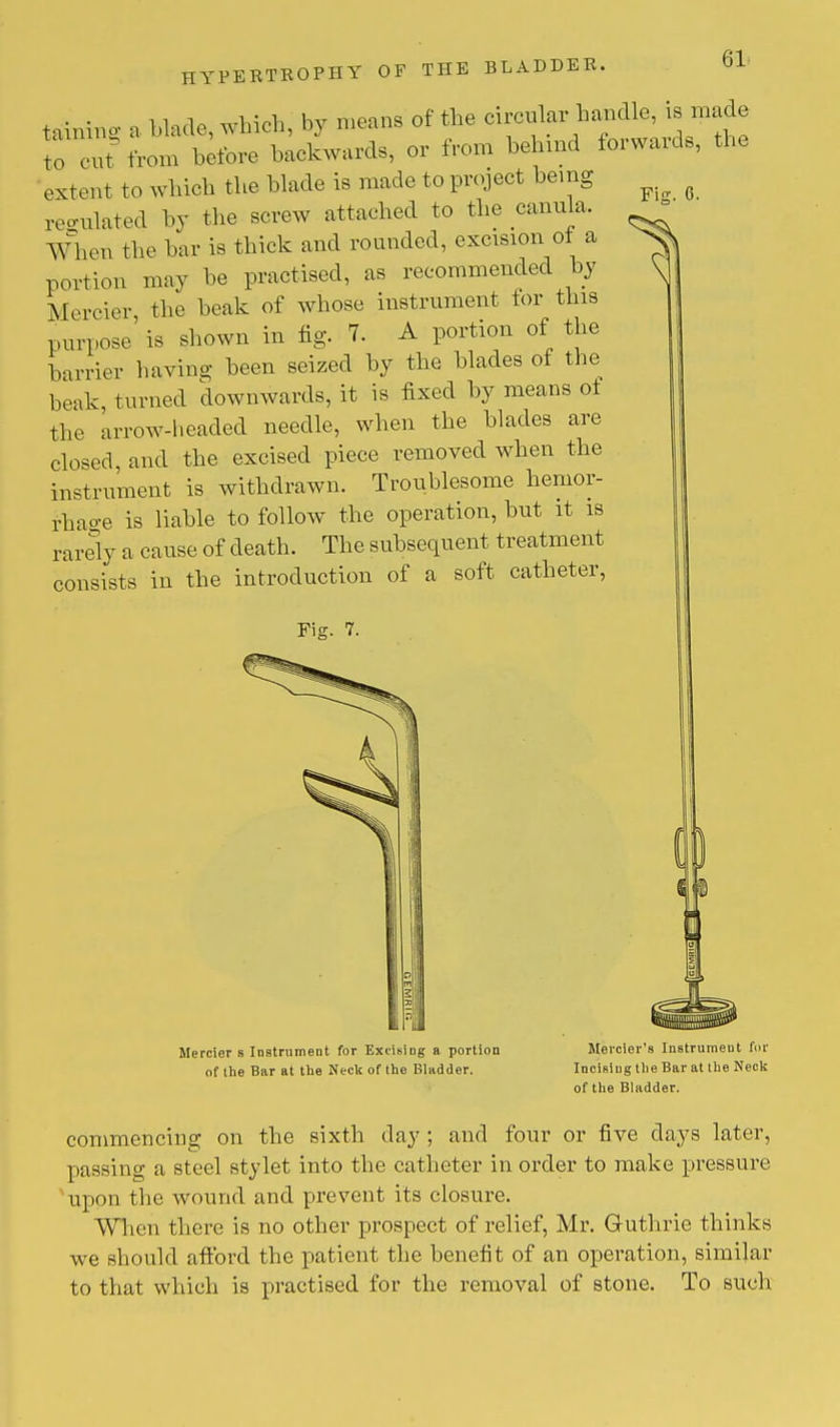 t.unlnil. a blaae, which, by means of the circular handle, is made Hut from before backwards, or from behind forwards, the extent to which the blade is made to project being ^ reo-ulated by the screw attached to the canula, When the bar is thick and rounded, excision ot a portion may he practised, as recommended by Mercier, the beak of whose instrument tor this purpose is shown in fig. 7. A portion of the barrier having been seized by the blades of the beak, turned downwards, it is fixed by means ot the arrow-headed needle, when the blades are closed, and the excised piece removed when the instrument is withdrawn. Troublesome hemor- rhage is liable to follow the operation, but it is rarely a cause of death. The subsequent treatment consists in the introduction of a soft catheter, Fig. 7. Mercier s Instrument for Excising a portion of the Bar at the Neck of the Bladder. Mercier's Instrument fur Incising the Bar at the Neck of the Bladder. commencing on the sixth day ; and four or five days later, passing a steel stylet into the catheter in order to make pressure upon the wound and prevent its closure. When there is no other prospect of relief, Mr. Guthrie thinks we should afford the patient the benefit of an operation, similar to that which is practised for the removal of stone. To such