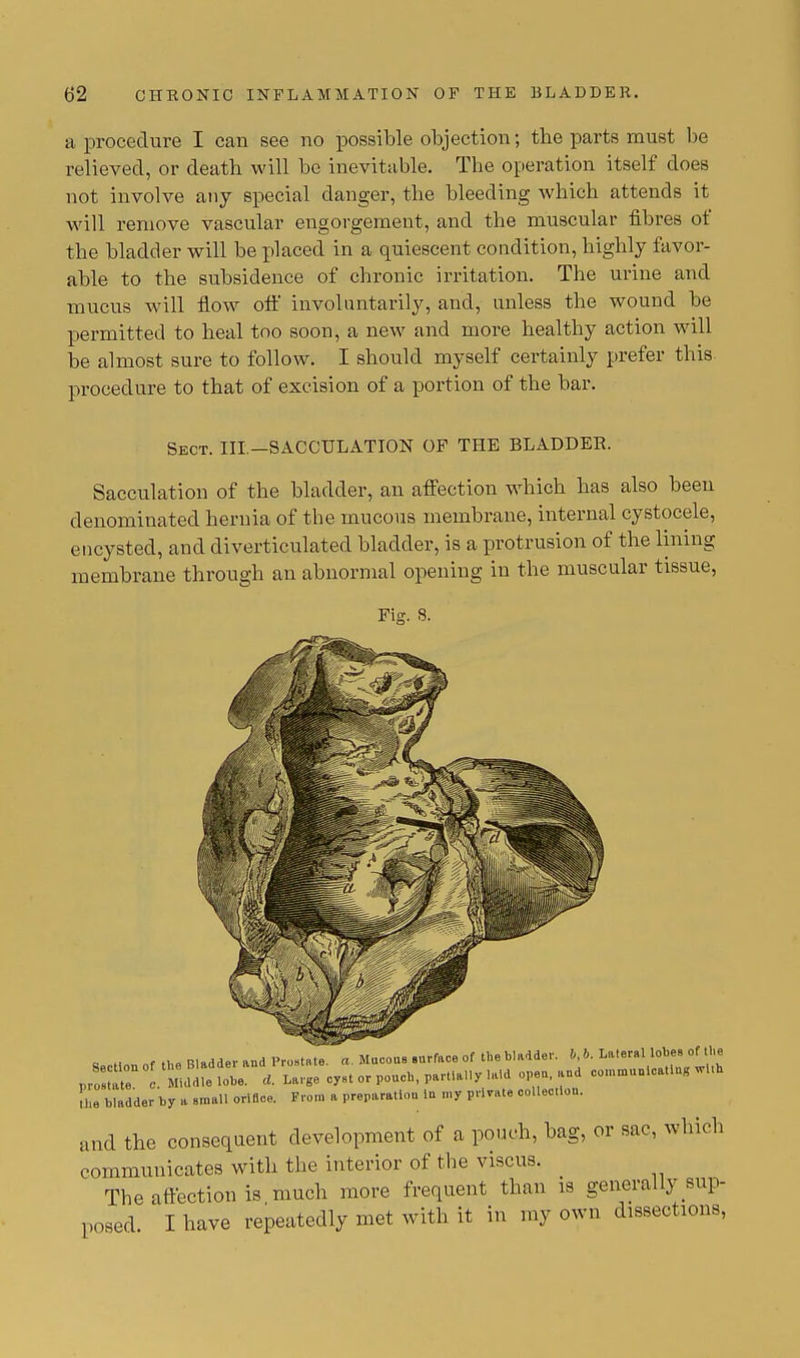 a procedure I can see no possible objection; the parts must be relieved, or death will be inevitable. The operation itself does not involve any special danger, the bleeding which attends it will remove vascular engorgement, and the muscular fibres of the bladder will be placed in a quiescent condition, highly favor- able to the subsidence of chronic irritation. The urine and mucus will flow off involuntarily, and, unless the wound be permitted to heal too soon, a new and more healthy action will be almost sure to follow. I should myself certainly prefer this procedure to that of excision of a portion of the bar. Sect. III.—SACCULATION OF THE BLADDER. Sacculation of the bladder, an affection which has also been denominated hernia of the mucous membrane, internal cystocele, encysted, and diverticulated bladder, is a protrusion of the lining membrane through an abnormal opening in the muscular tissue, Fiar. S. a „ nftl,fl Bladder and Prolate, a. Mucous Burface of the bladder, b, b. Lateral lobes of the pr:;r 1 Middle ^ ^^v^t™ L Madder by a small orifice. From a preparatiou lu my private collection. and the consequent development of a pouch, bag, or sac, which communicates with the interior of the viscus. The affection is much more frequent than is generally sup- posed. I have repeatedly met with it in my own dissections,