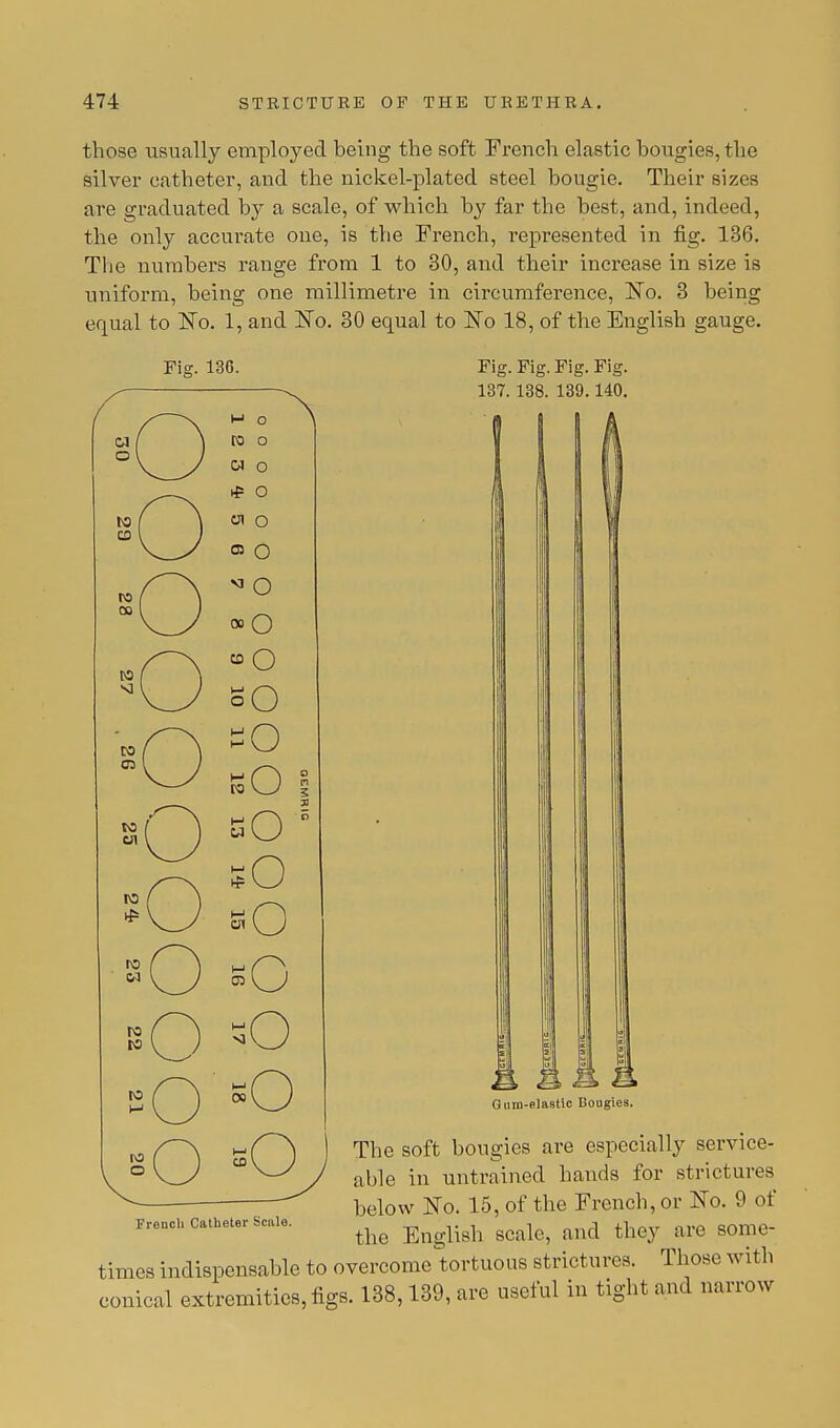 those usually employed being the soft French elastic bougies, the silver catheter, and the nickel-plated steel bougie. Their sizes are graduated by a scale, of which, by far the best, and, indeed, the only accurate one, is the French, represented in fig. 136. The numbers range from 1 to 30, and their increase in size is uniform, being one millimetre in circumference, No. 3 being equal to No. 1, and No. 30 equal to No 18, of the English gauge. Fig. 136. Fig. Fig. Fig. Fig. 137. 138. 139.140. 4 k Gum-elastic Bougies. The soft bougies are especially service- able in untrained hands for strictures below No. 15, of the French, or No. 9 of the English scale, and they are some- times indispensable to overcome tortuous strictures. Those with conical extremities, figs. 138,139, are useful in tight and narrow French Catheter Scale.